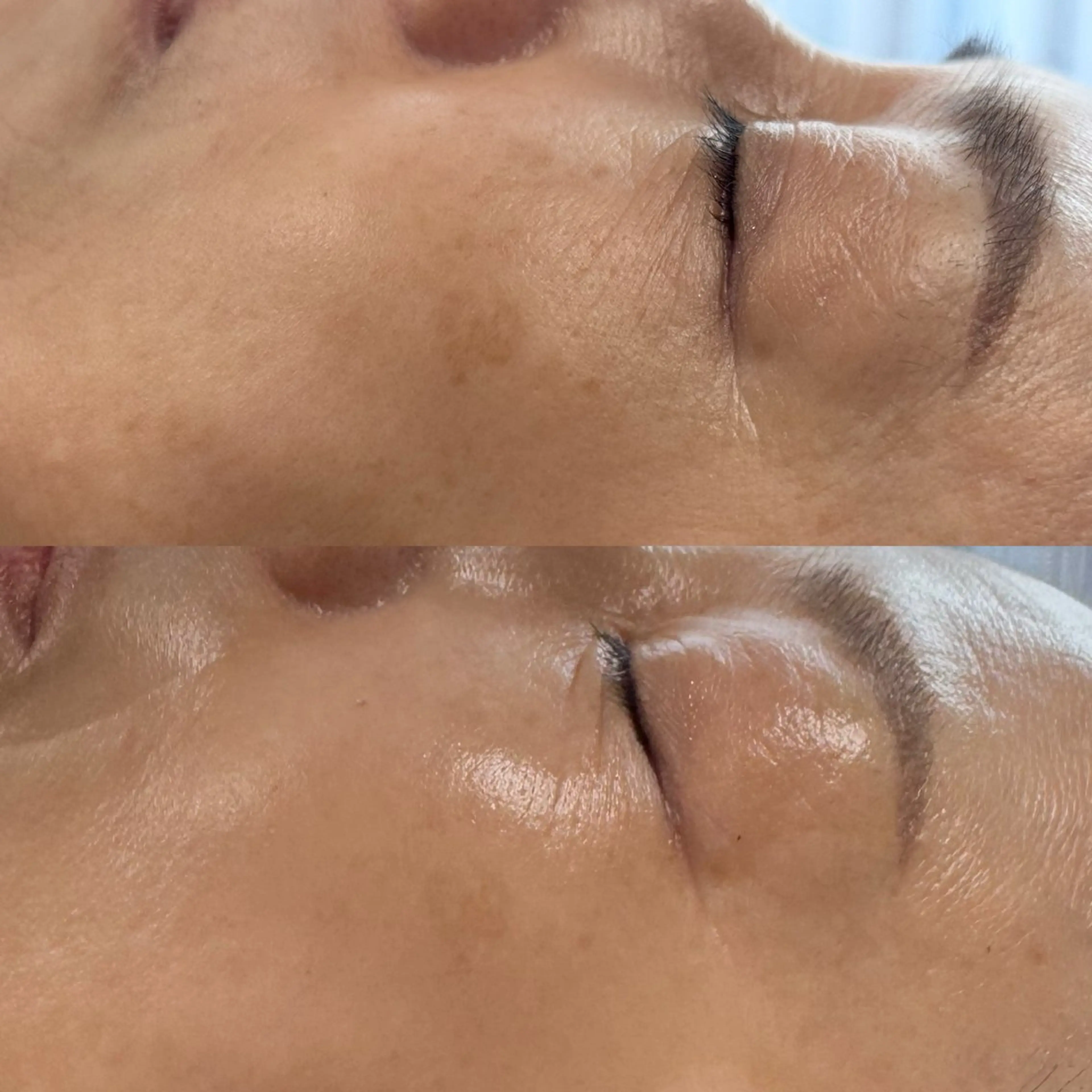 エステ skinity所属・ピーリング専門サロン skinityのエステ・リラクイメージ