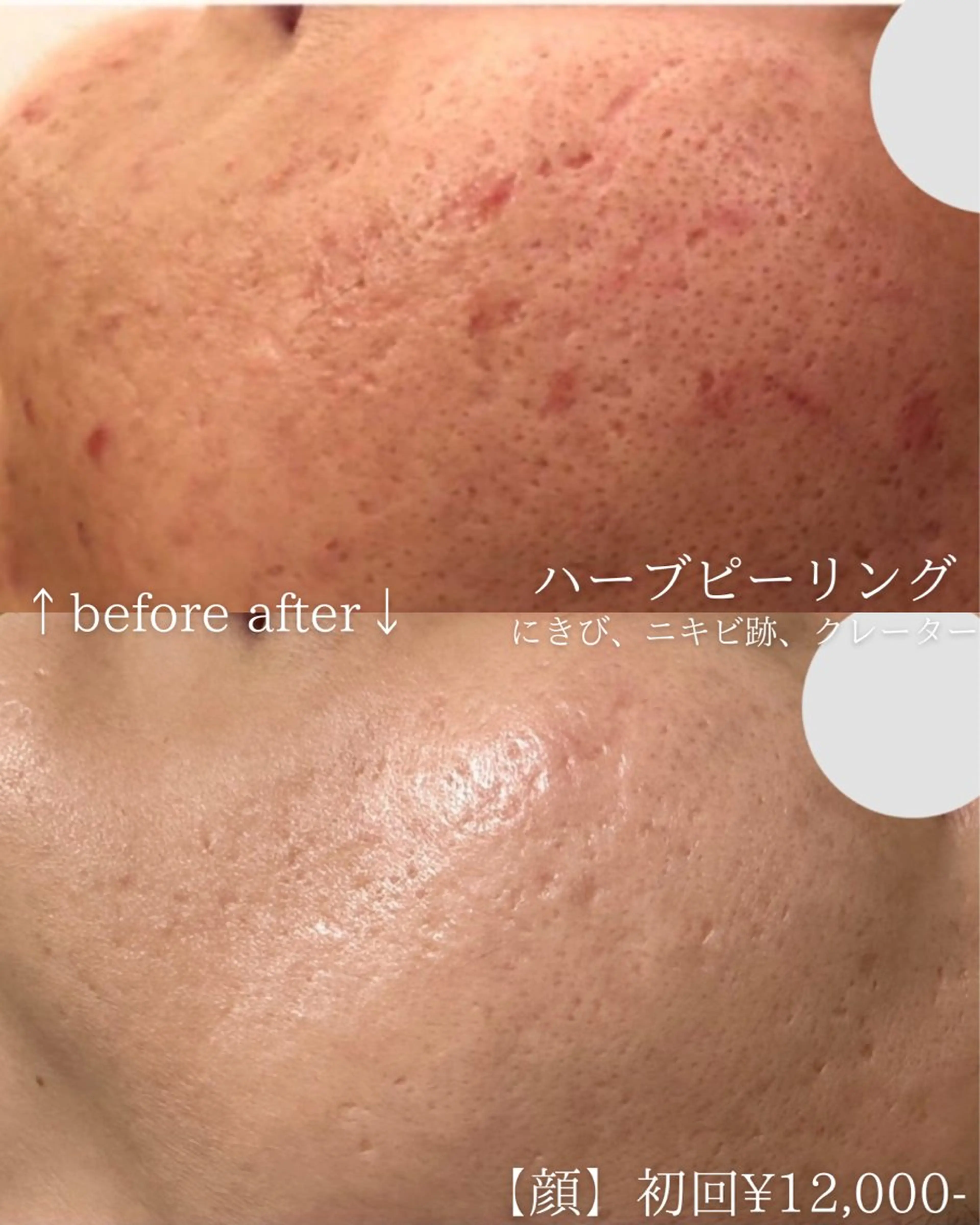 エステ ニキビ改善専門店 d'Albaのエステ・リラクイメージ