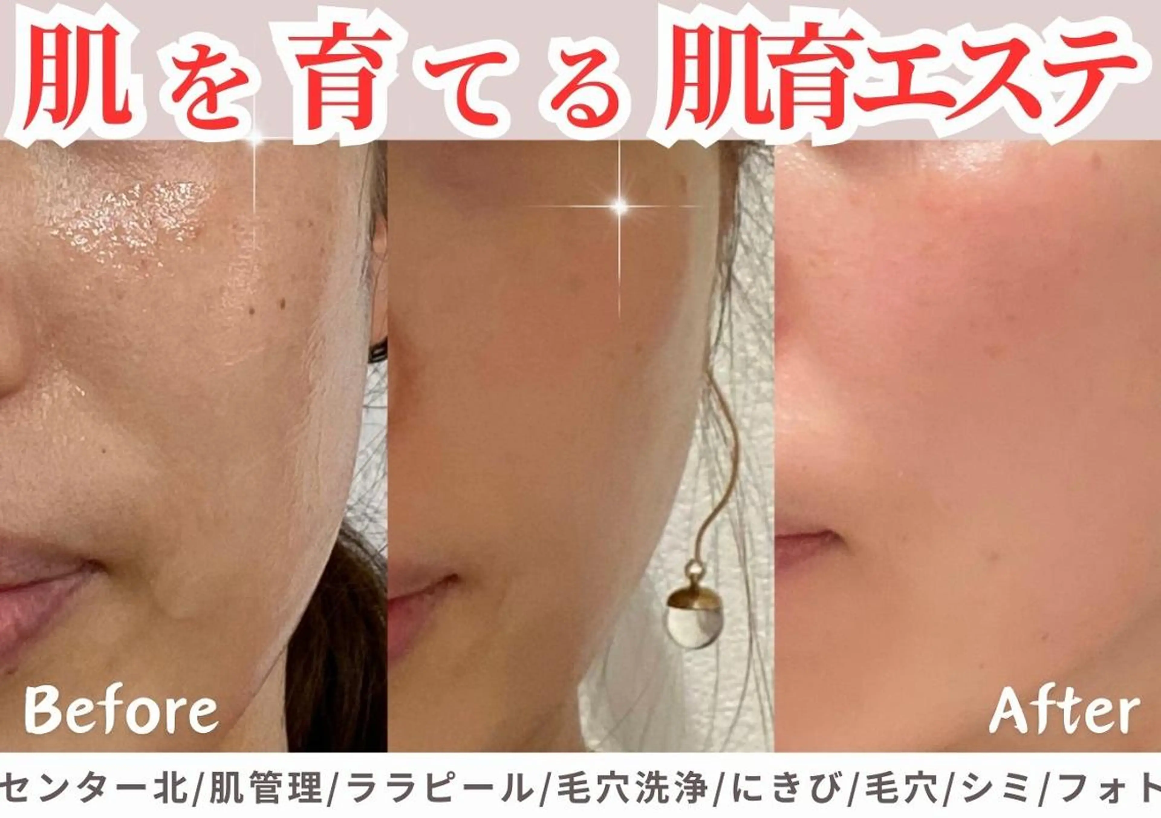 sii センター北 AIのエステ・リラクイメージ