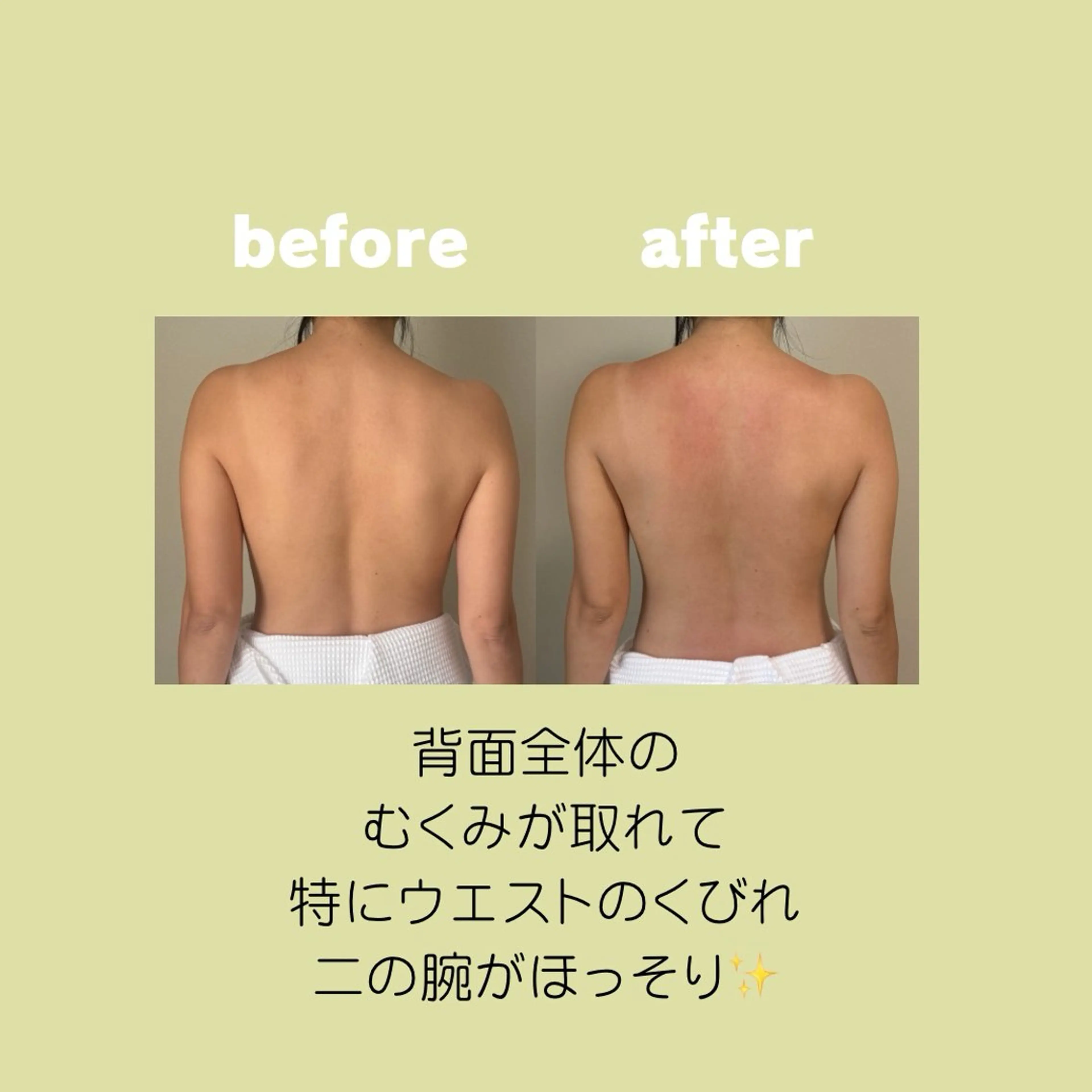 リラクゼーションスパ　ひのき所属・spaHINOKI 【女性専用】のエステ・リラクイメージ