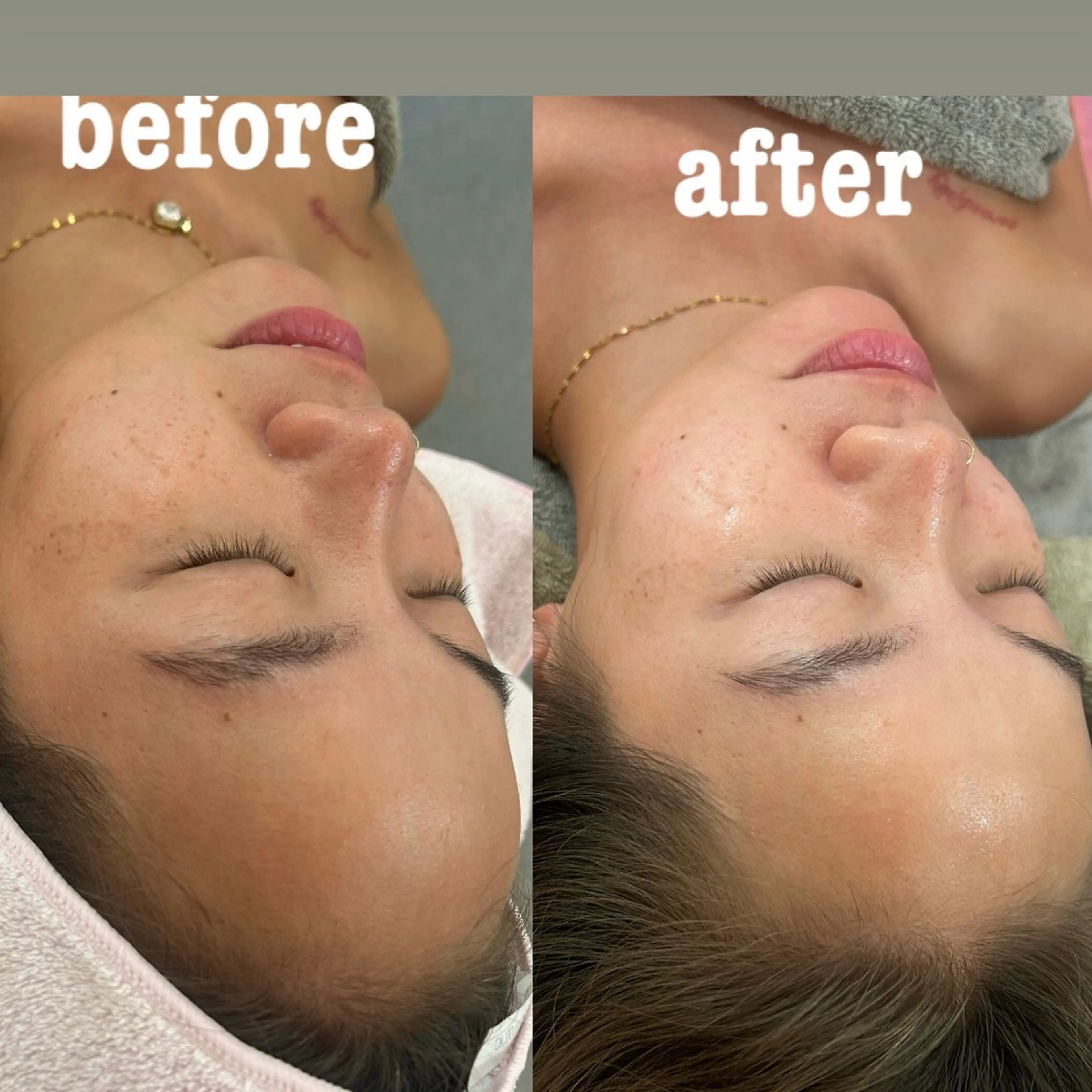 エステ リラク 美容鍼灸サロン mahoroba院長のエステ・リラクイメージ