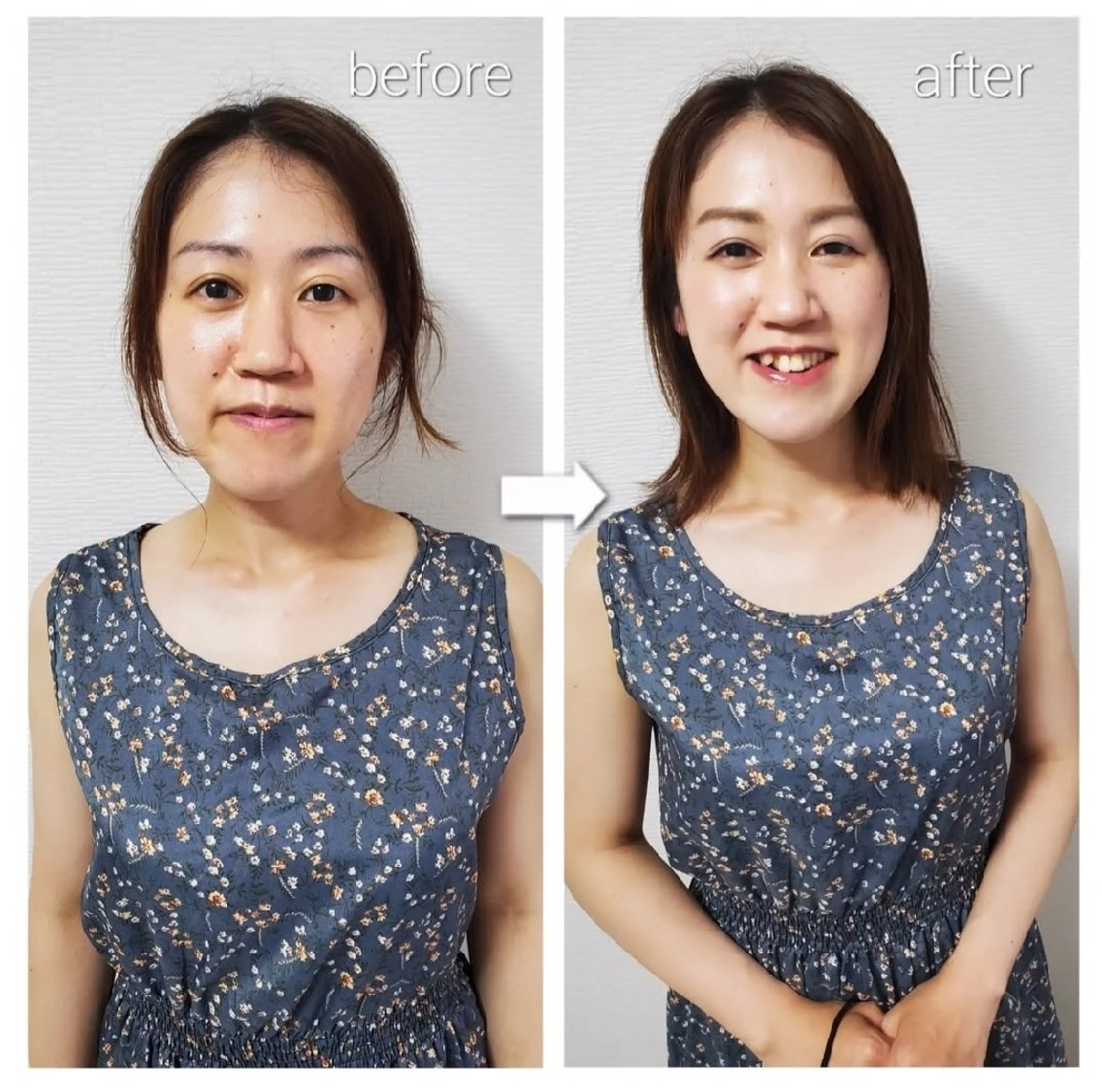 その他 Lys.totalbeauty所属・お値段以上‼️ 垢抜けお任せ maiのその他イメージ