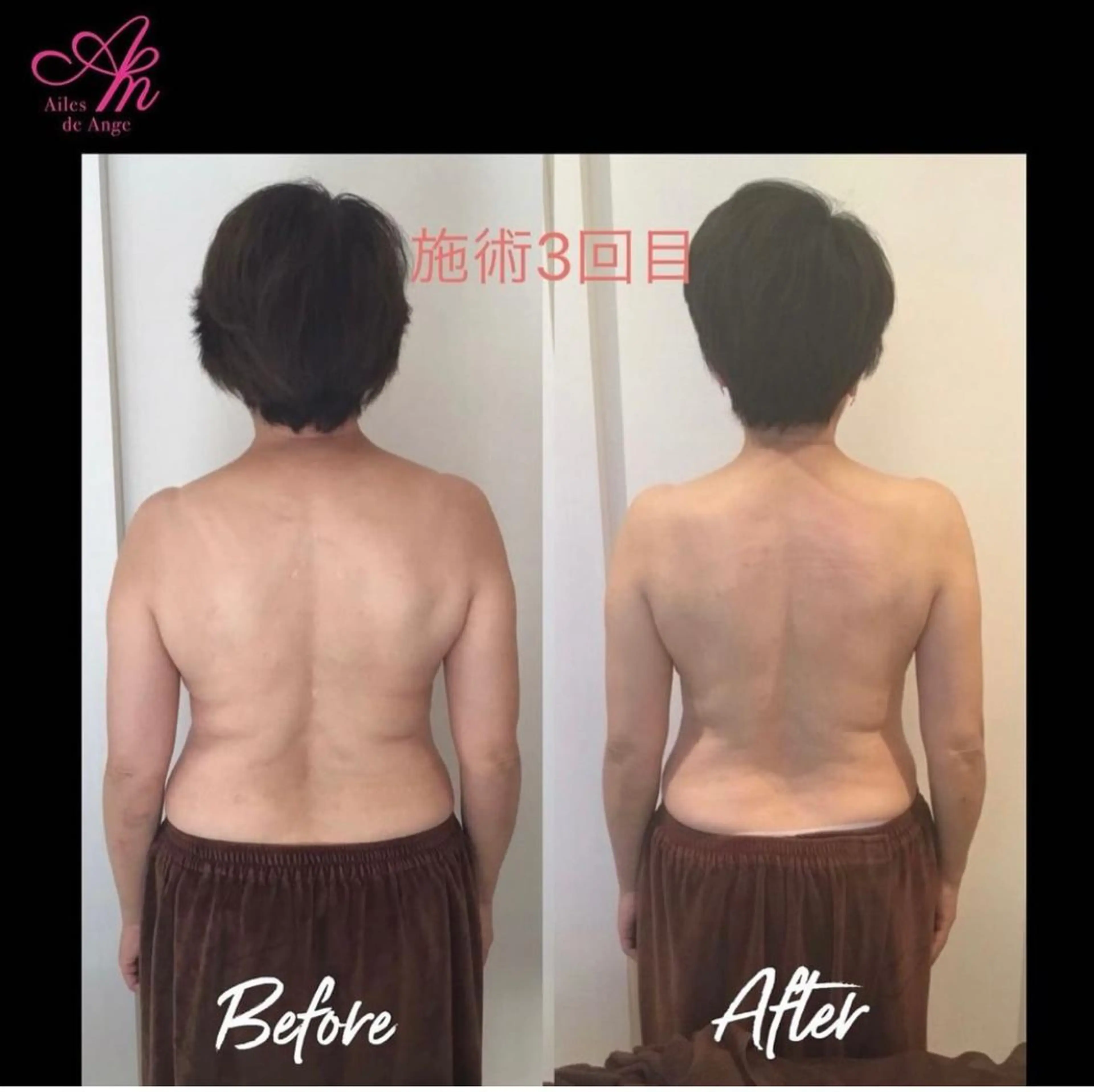 ロング 小顔カット トリートメント Ailes de Ange　MARIのエステ・リラクイメージ