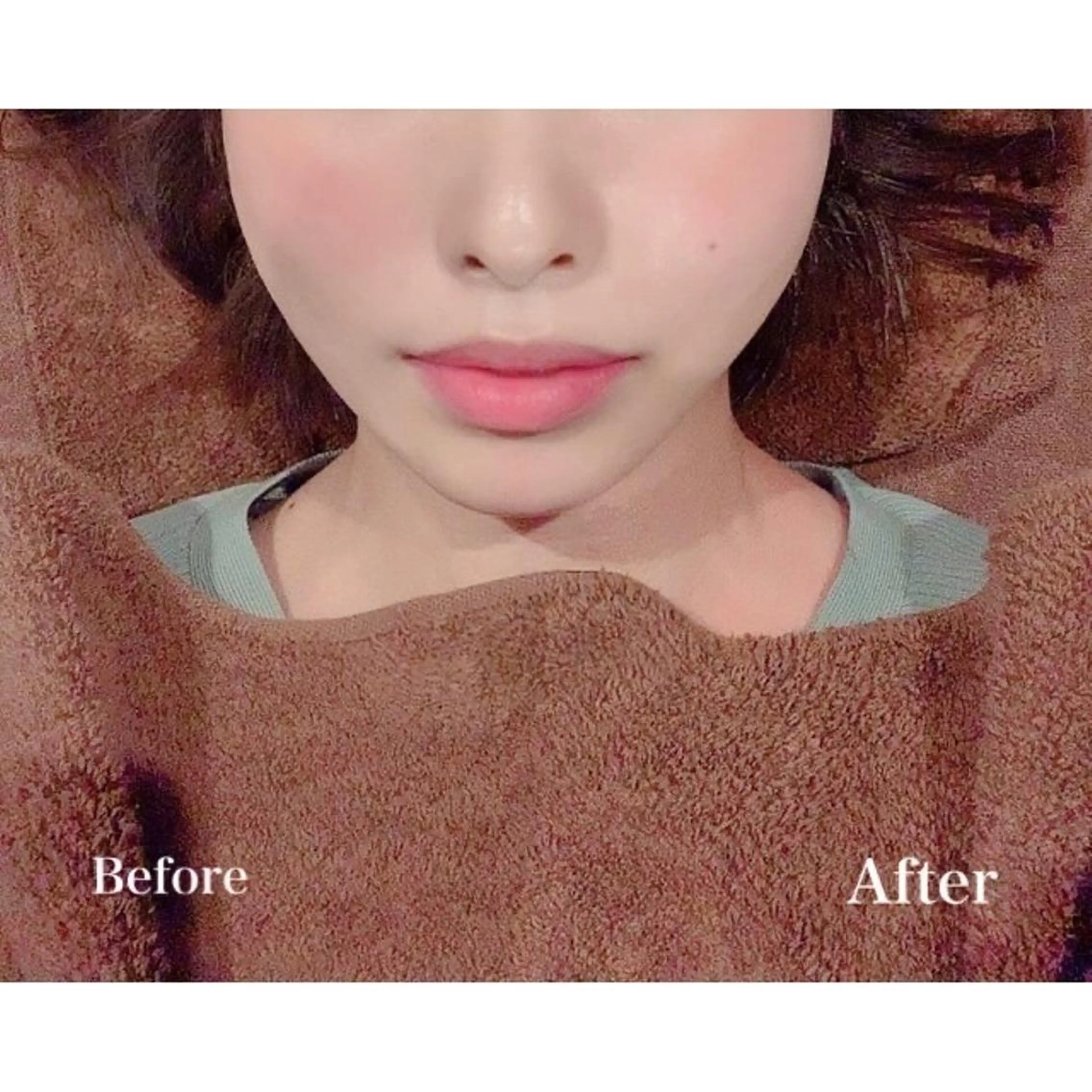 美容鍼灸サロン LOMIHARIのエステ・リラクイメージ