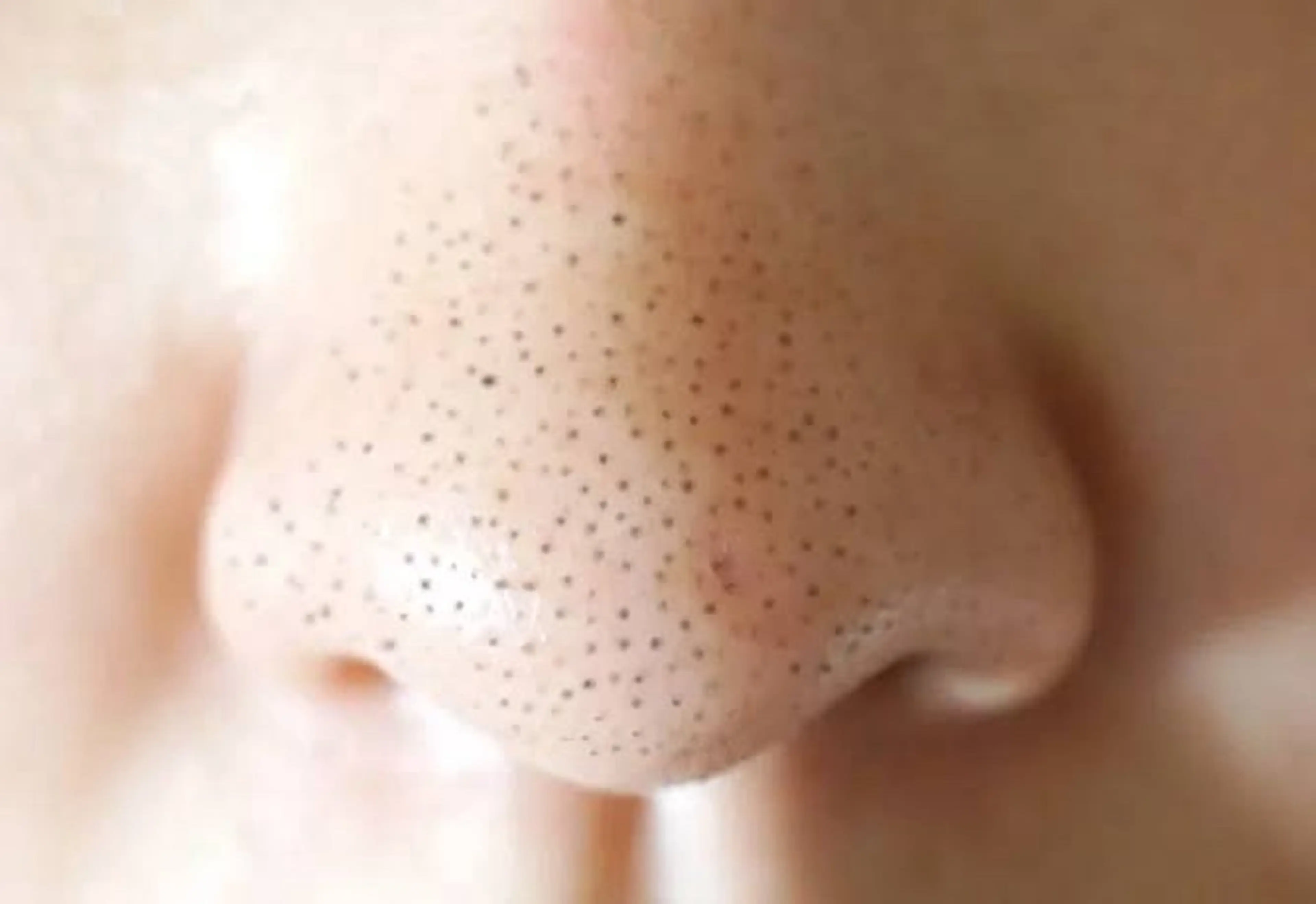 ヒーリングサロン メリッサ/tooSMILE所属・大屋 詩織のエステ・リラクイメージ