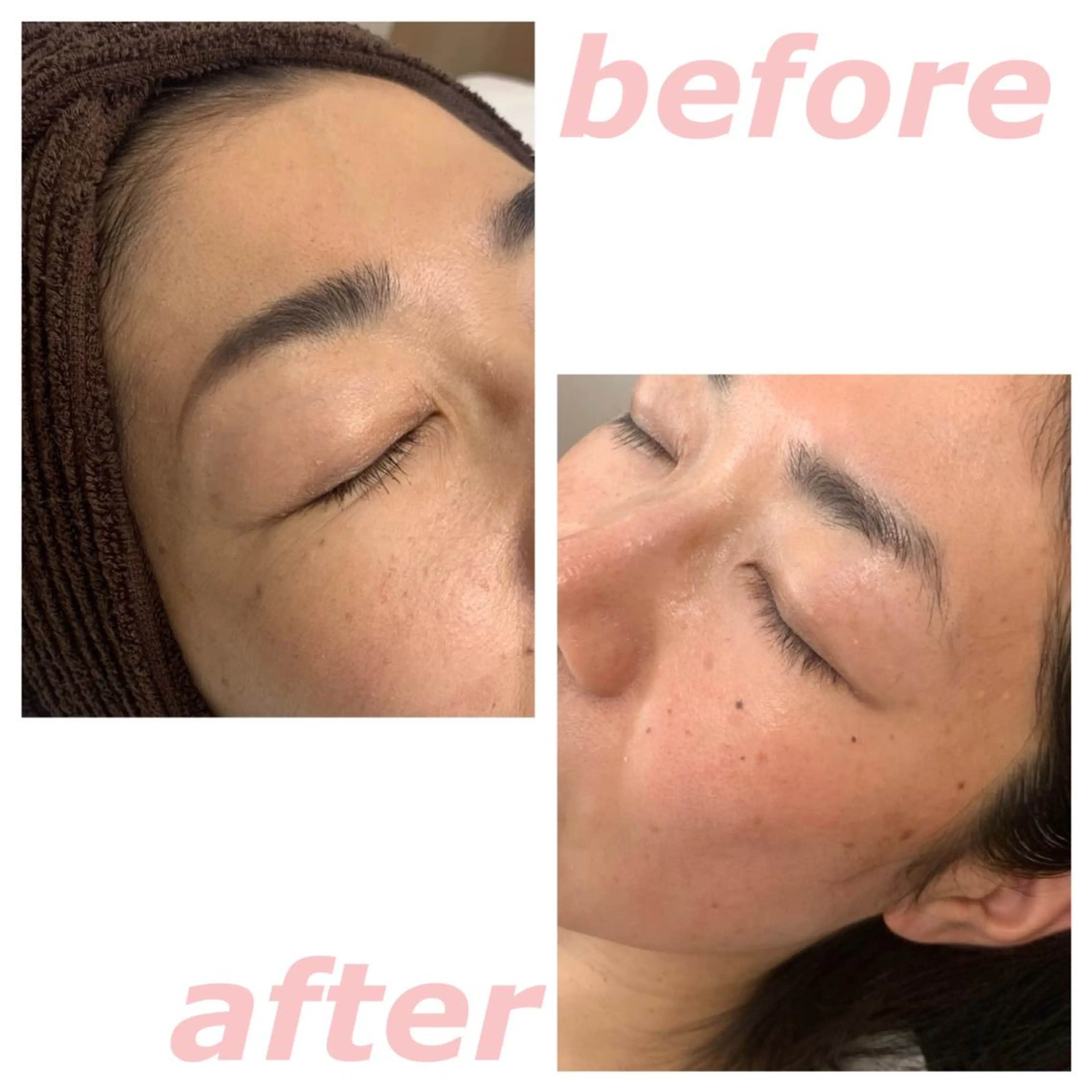 lafleur Yurinaのエステ・リラクイメージ