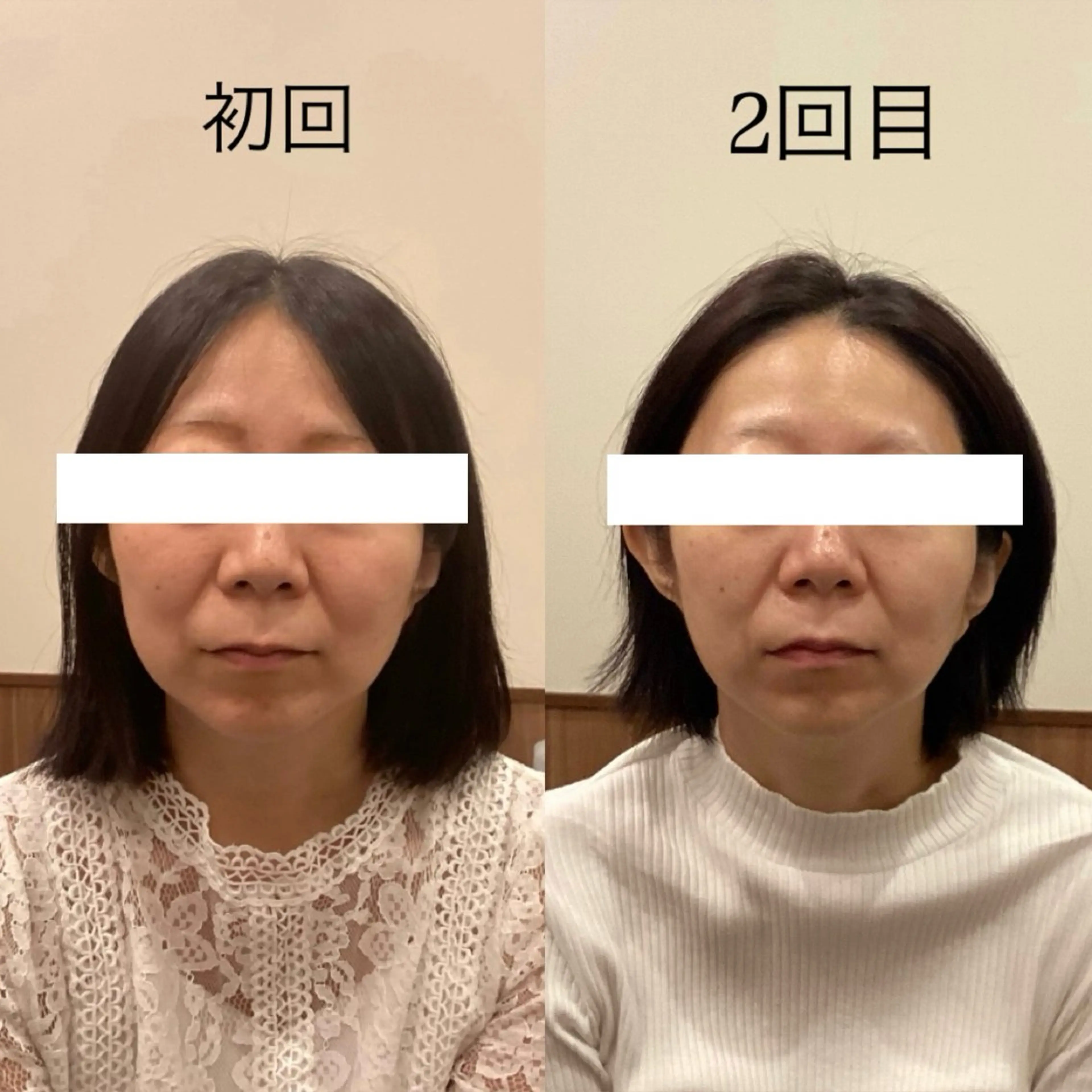 エステ リラク Hari Lounge恵比寿所属・chika🦋 ハリラウンジ恵比寿のエステ・リラクイメージ