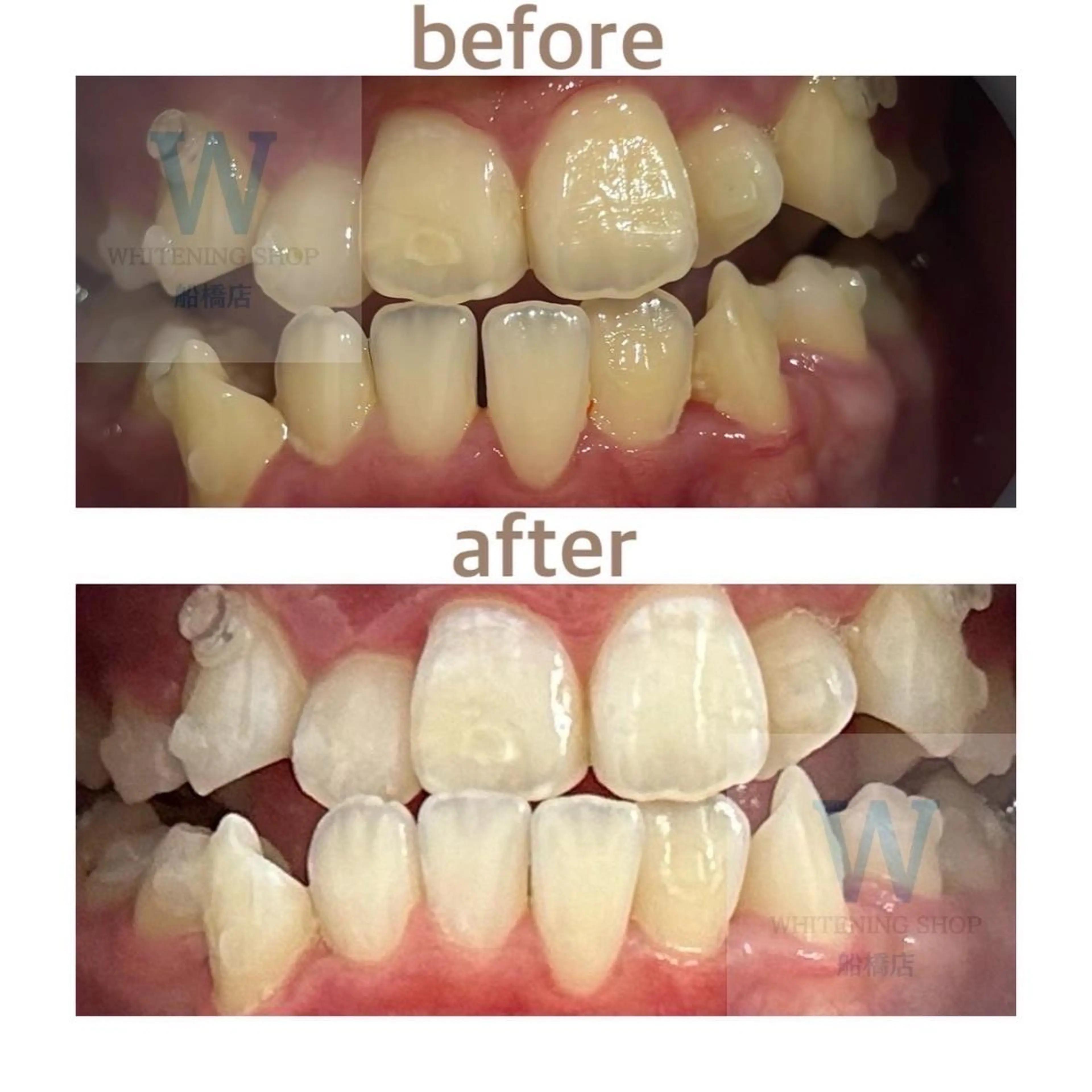 ホワイトニング ショップ船橋店🦷のエステ・リラクイメージ