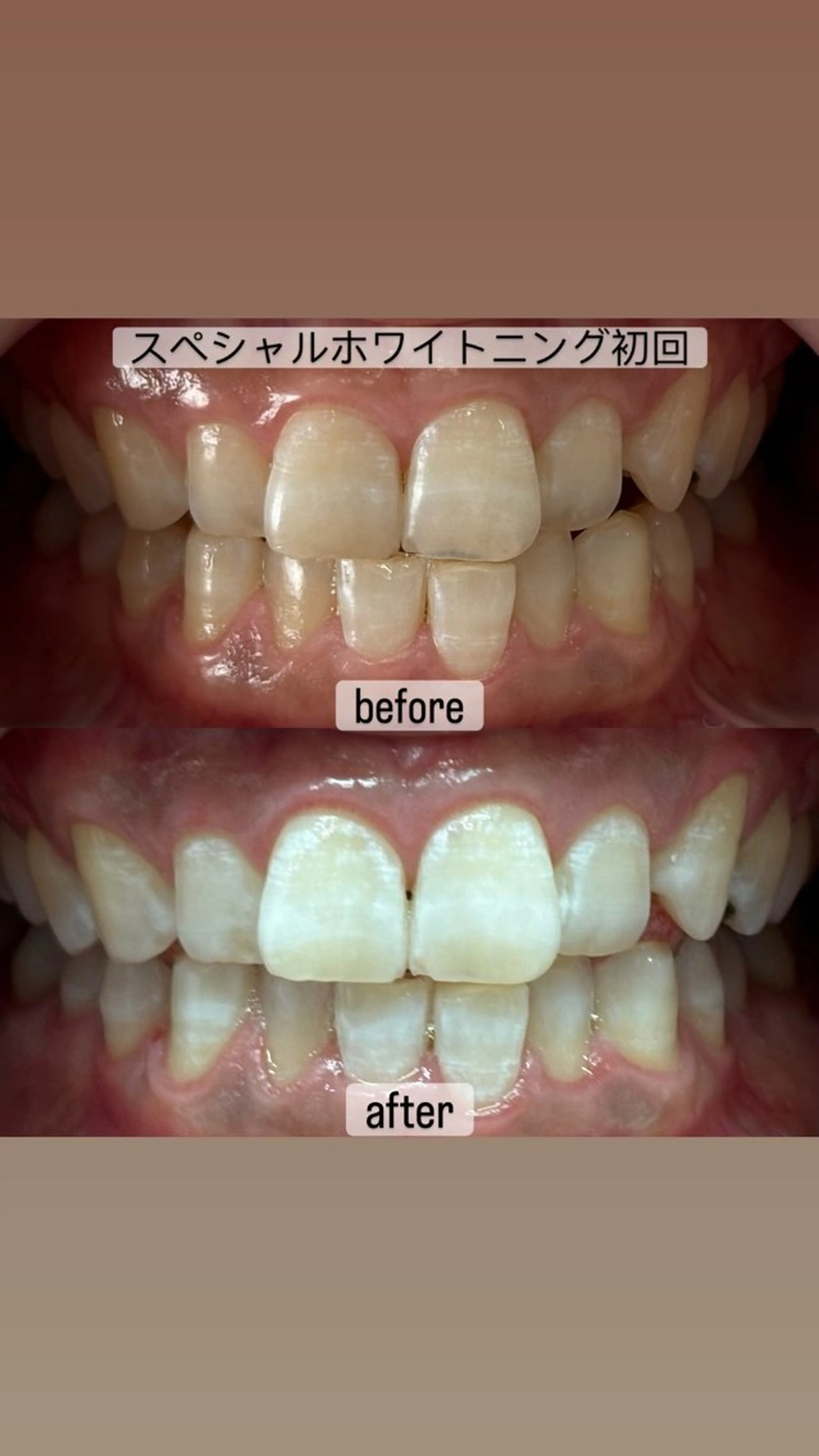 その他 whitening salon yatto.所属・ホワイトニングサロン yatto.のその他イメージ
