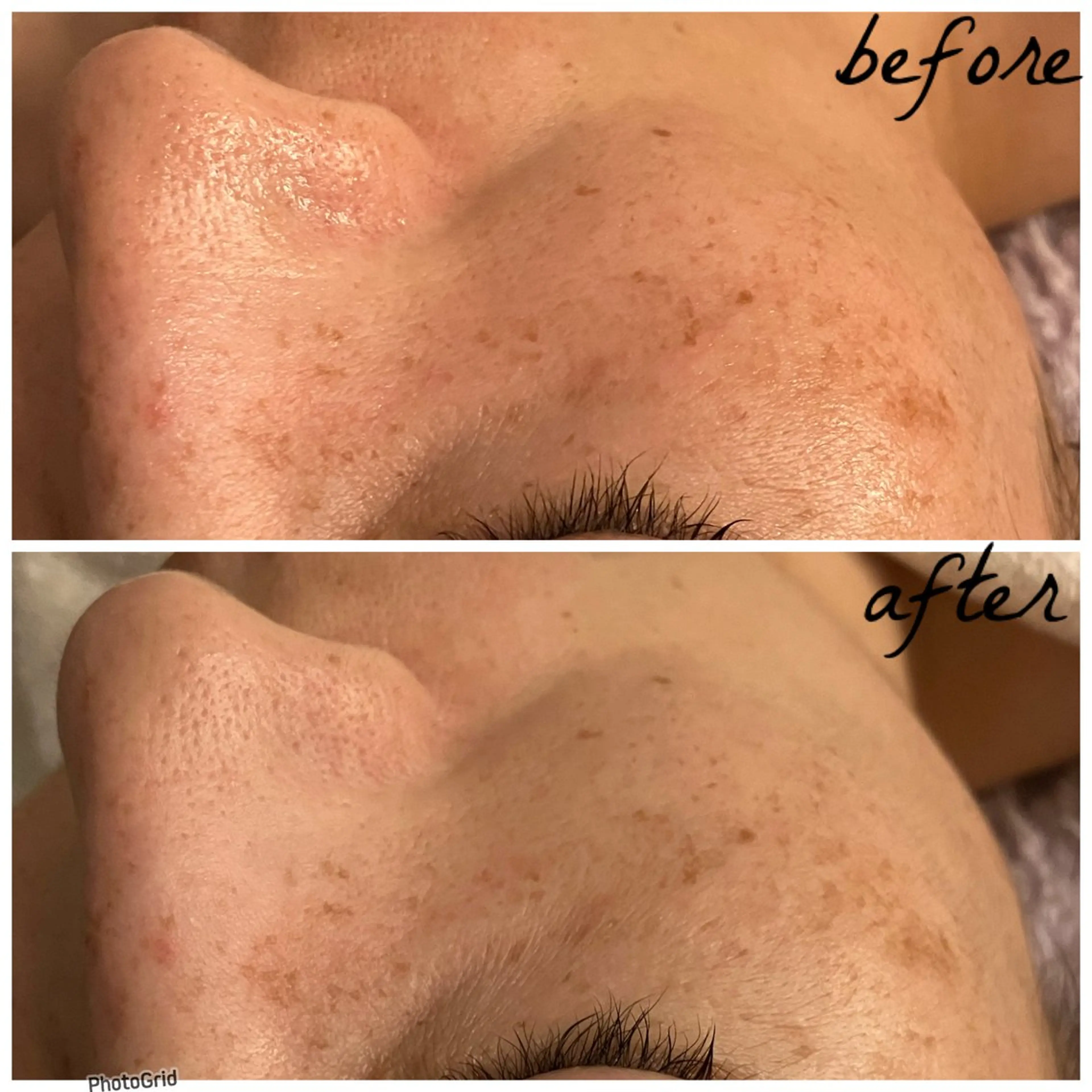 メンズ エステ メナード岐阜茜部 杉浦のエステ・リラクイメージ