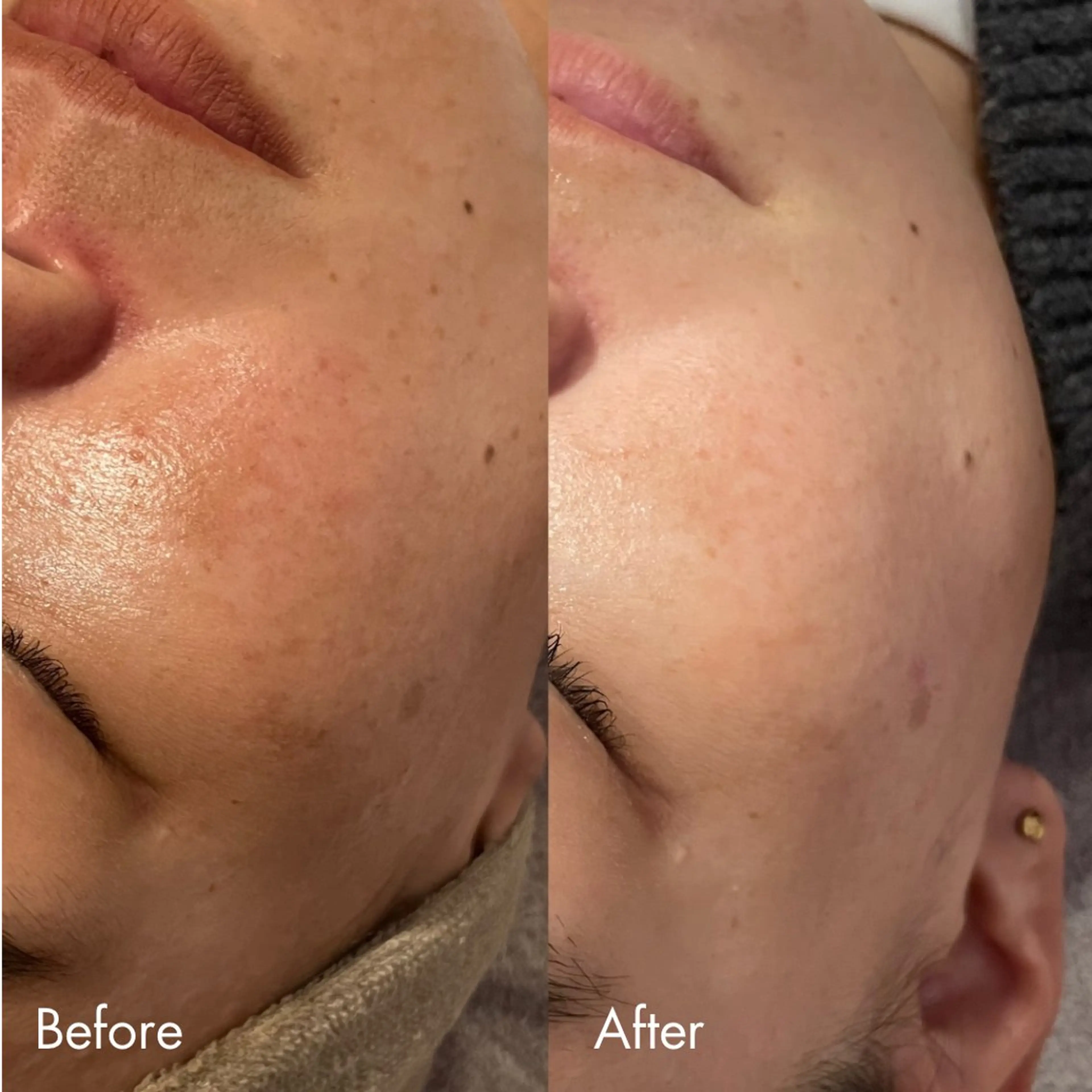 エステ Lassy Yuriの眉毛・アイブロウイメージ