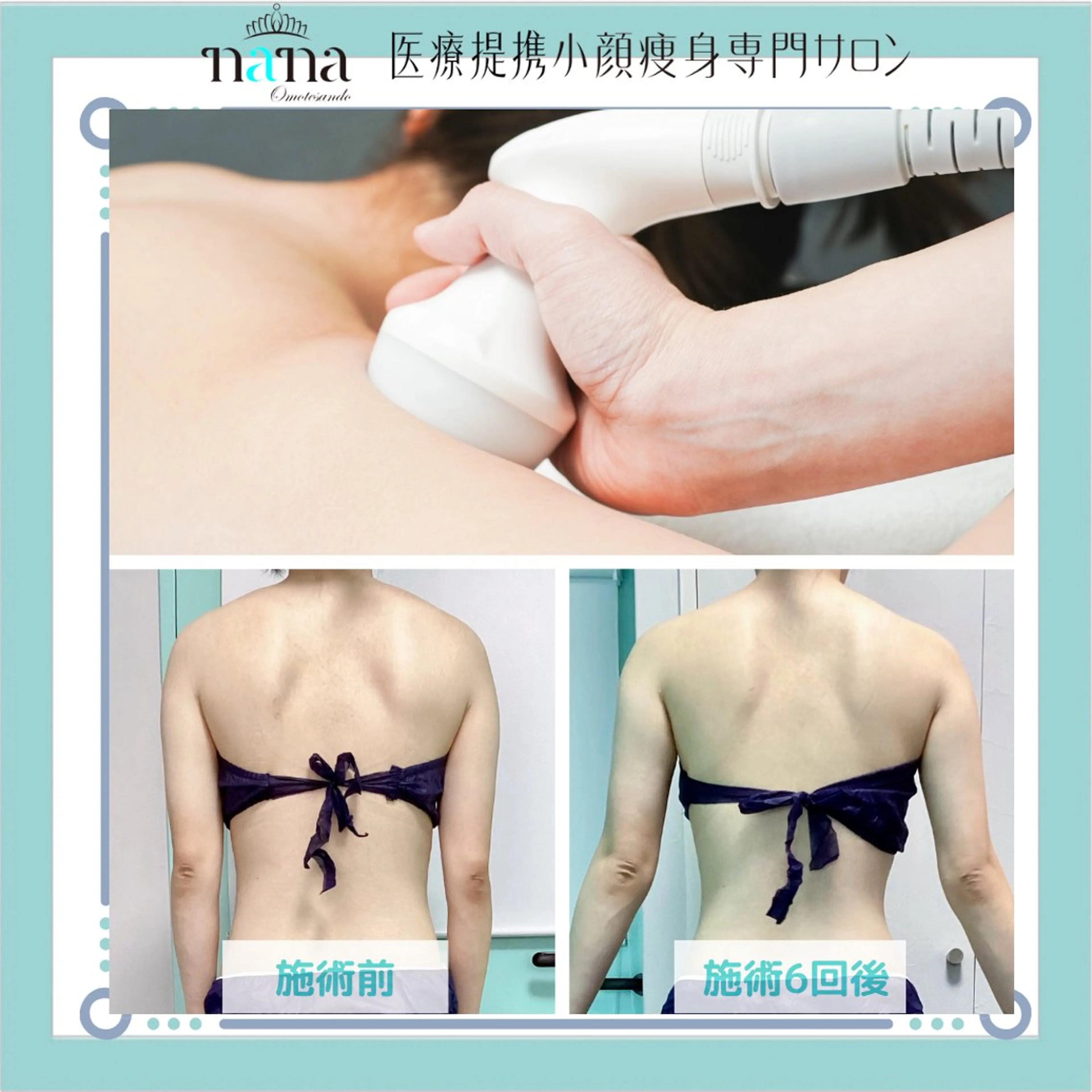 小顔痩身インディバ Nana表参道のエステ・リラクイメージ