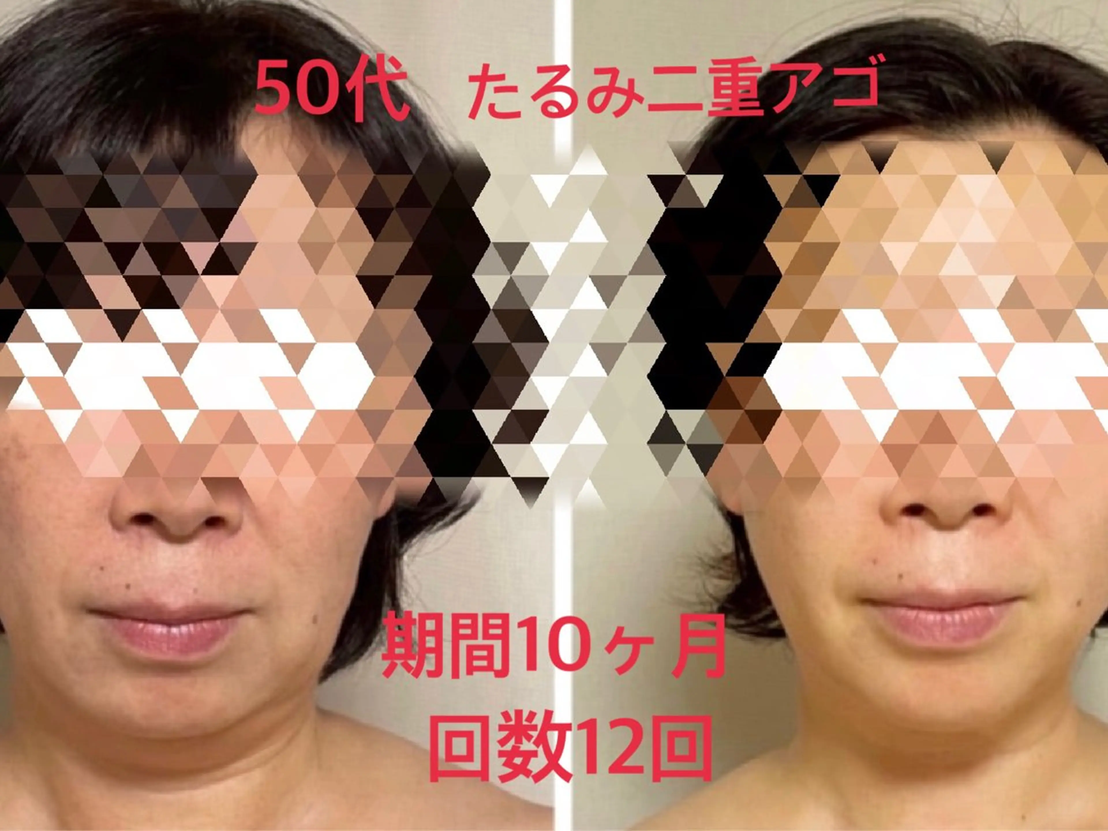エステ CHANCEシャンス HRMのエステ・リラクイメージ
