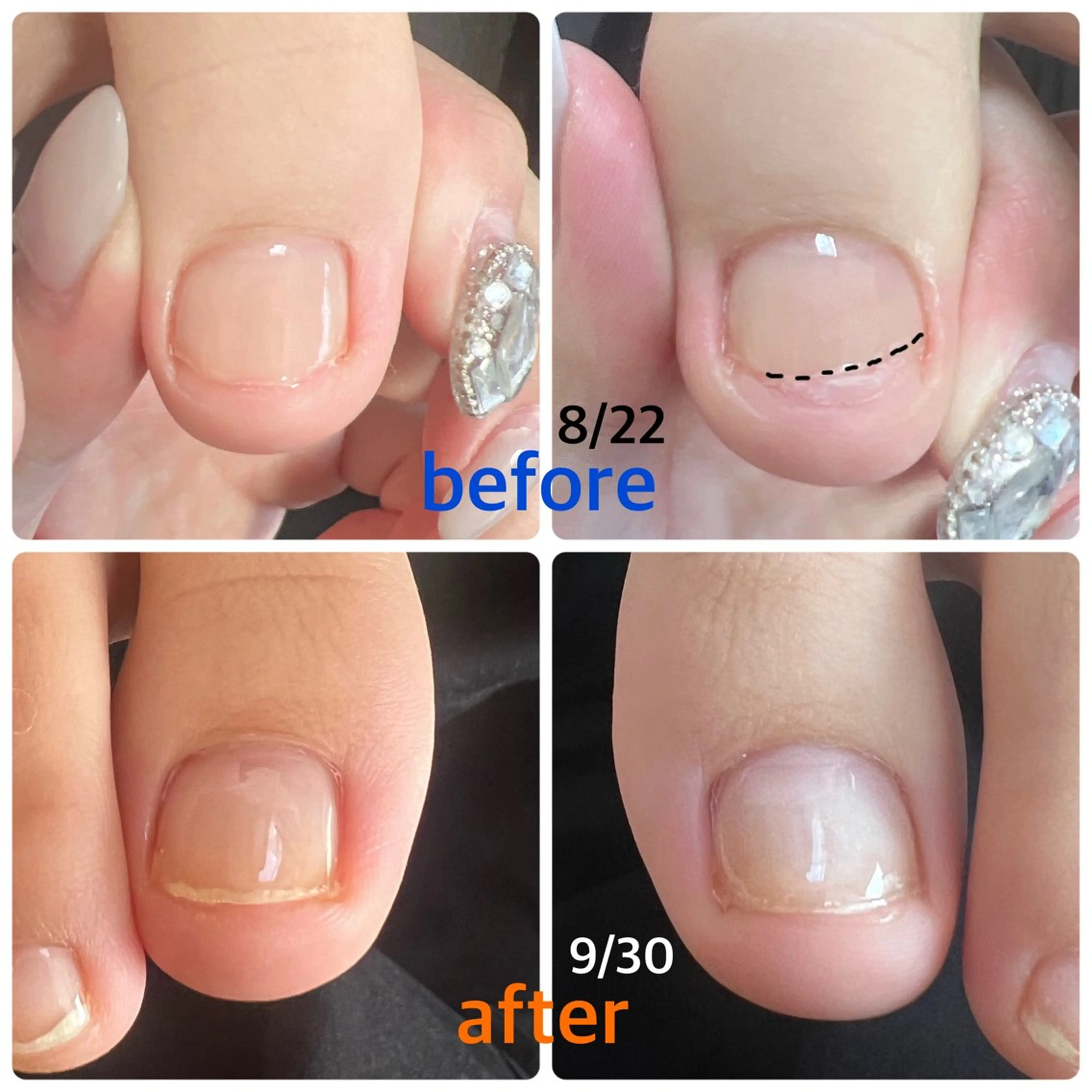 ネイル フットネイル ジェルネイル フットネイル Nail Salon Espoir所属・上條 優希のネイルデザイン