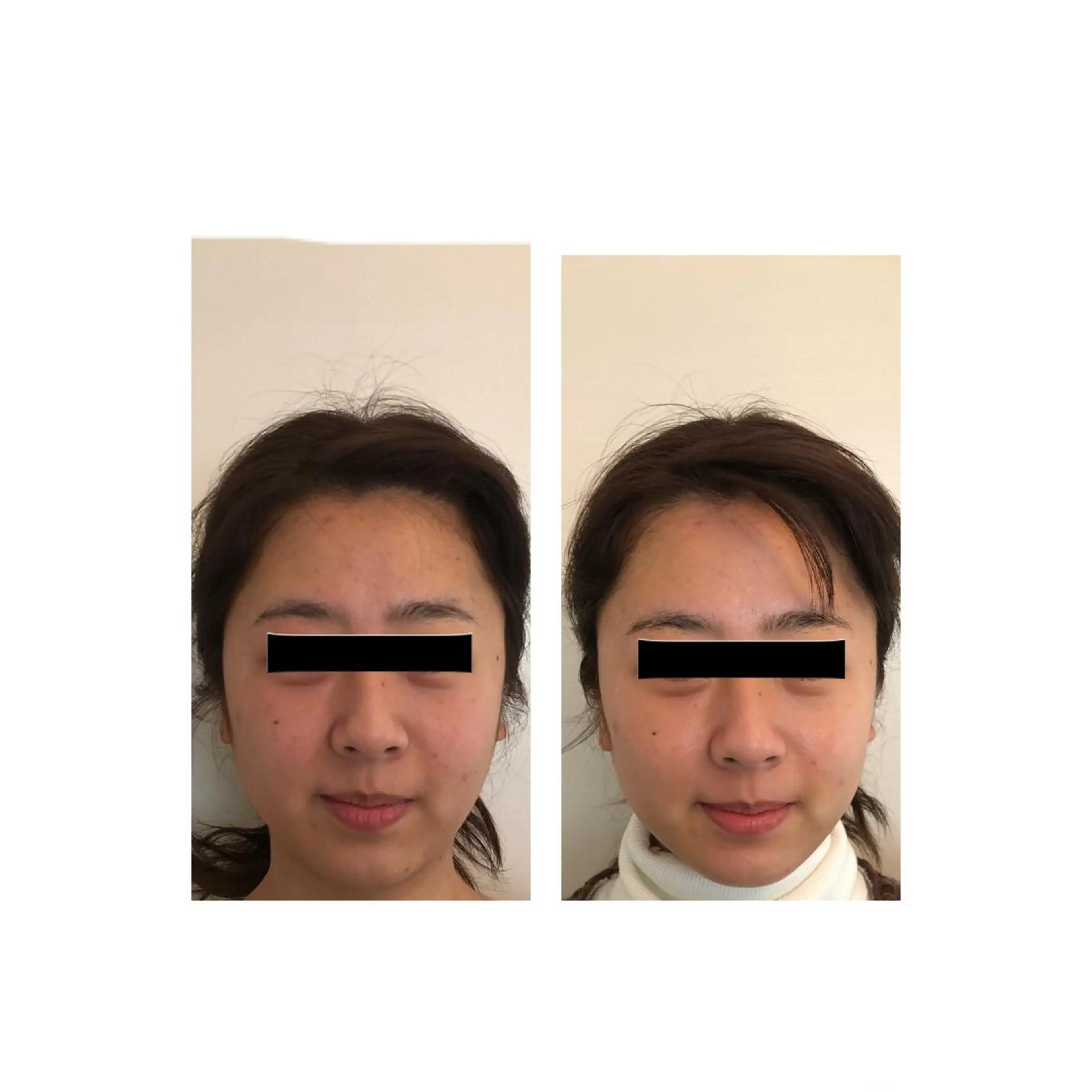 おうちサロン B-ROOMのエステ・リラクイメージ