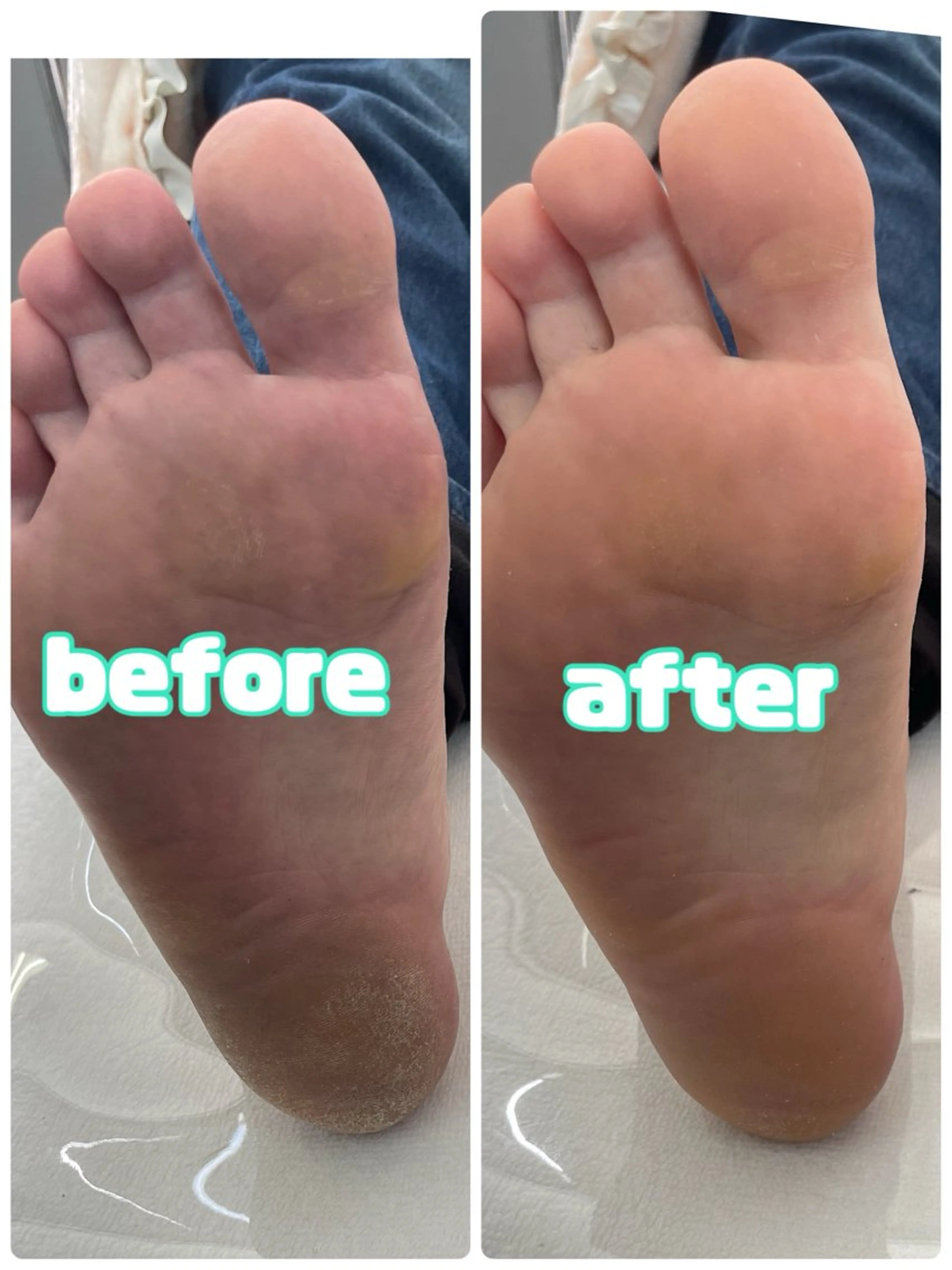 メンズ キッズ 肌質改善・脱毛サロン Luangeのエステ・リラクイメージ