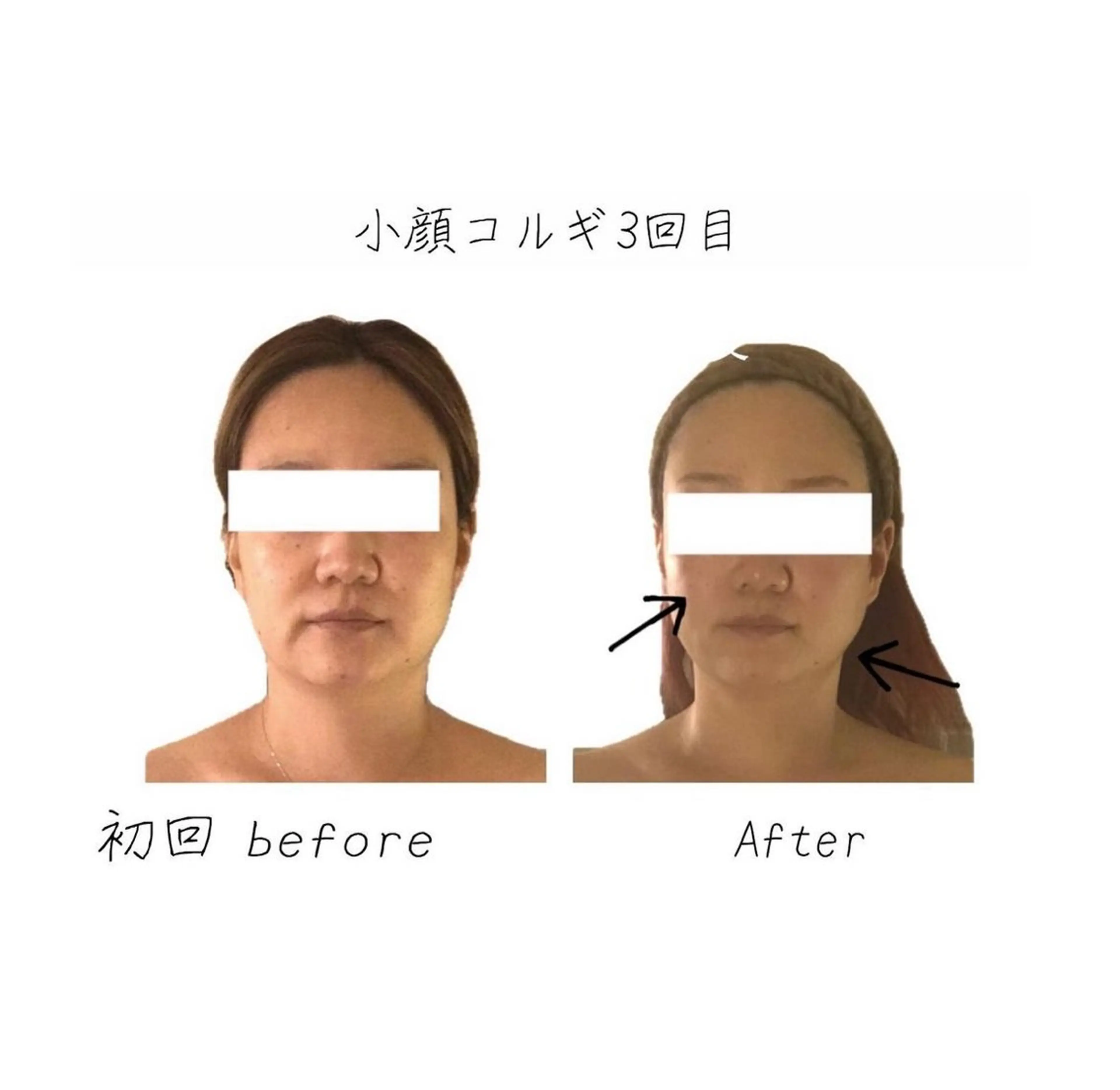 エステ リラク 小顔コルギ専門店/隠れ家サロン《여름ヨルム》所属・小顔コルギ専門店 《ヨルム》龍ケ崎店のエステ・リラクイメージ