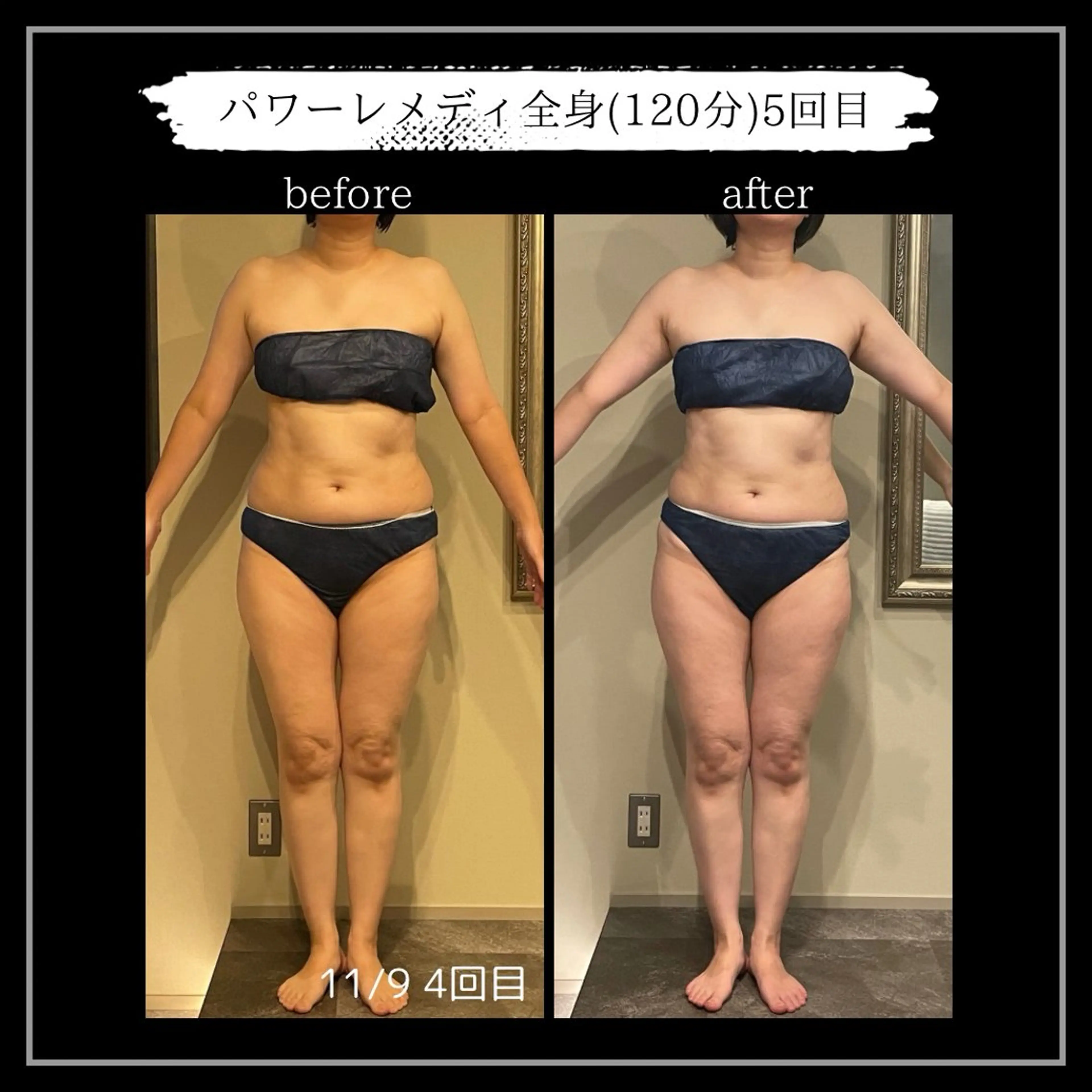 エステ リラク オフ:オン所属・オフ:オン 全身筋膜マッサージのエステ・リラクイメージ