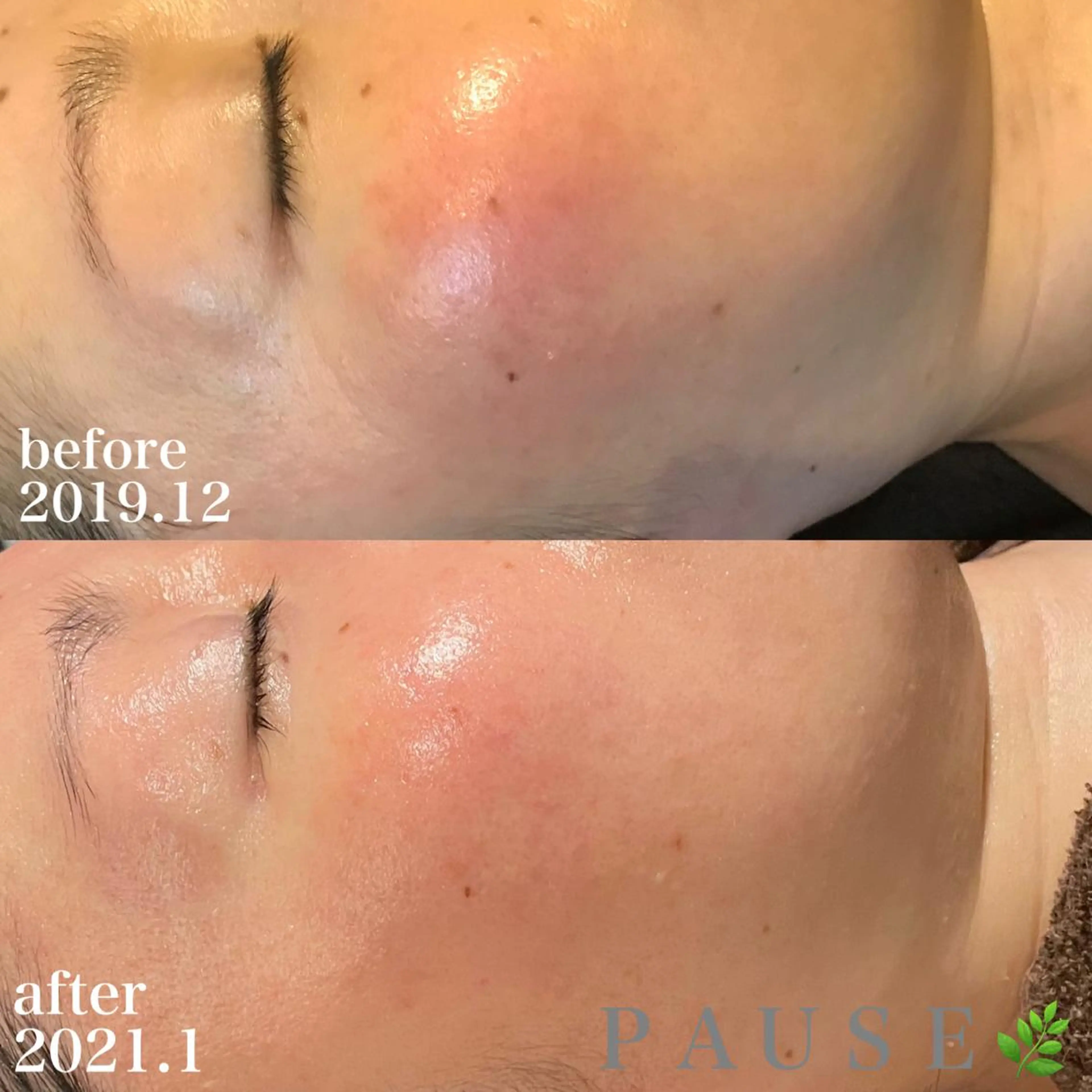 エステ リラク 浜野 恵美のエステ・リラクイメージ