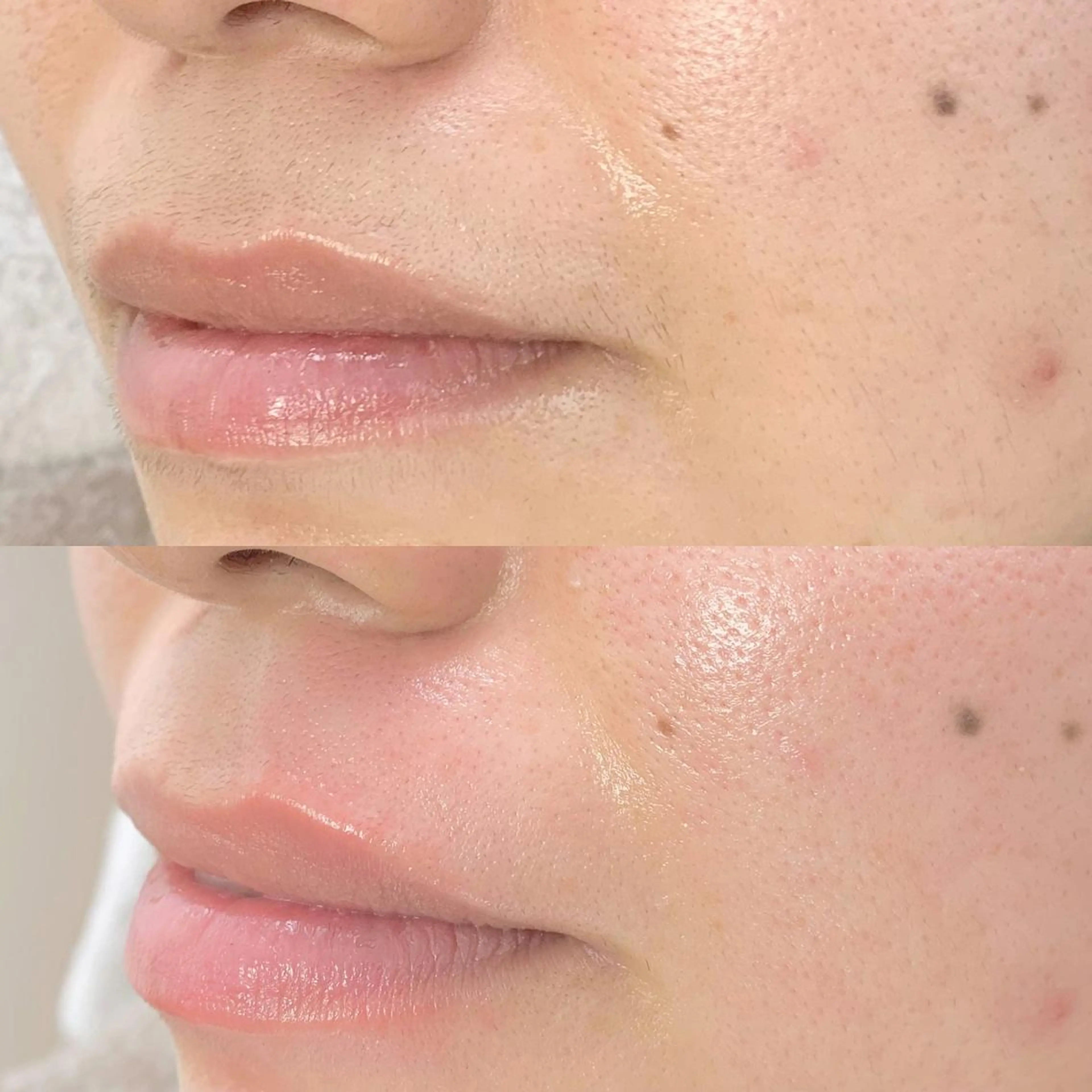 メンズ 脱毛 salonLADYSTYLE所属・稲嶺 美華のエステ・リラクイメージ