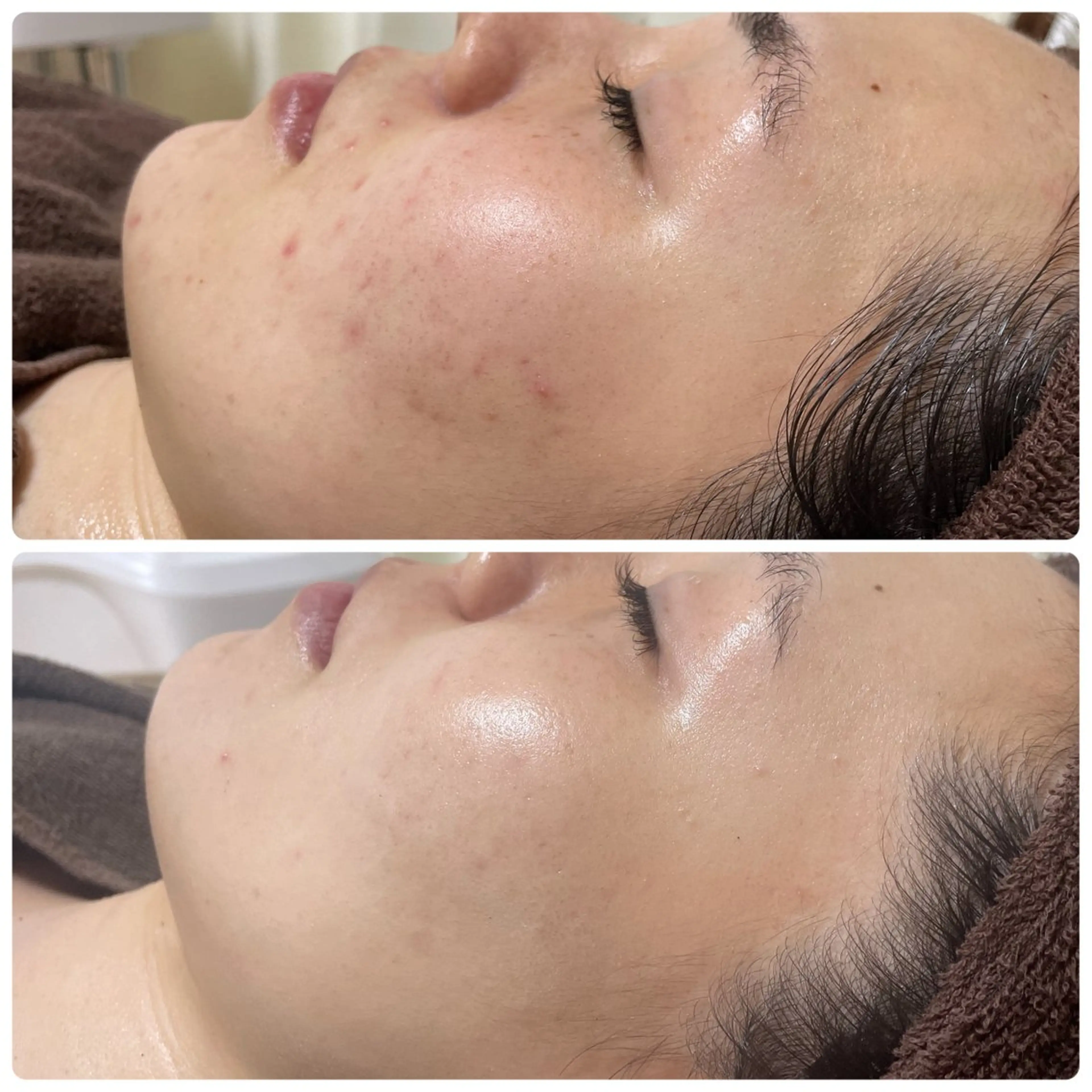 その他 NiU.BEAUTY🥥池袋店所属・ハーブピーリング専門 NiU.BEAUTYのエステ・リラクイメージ