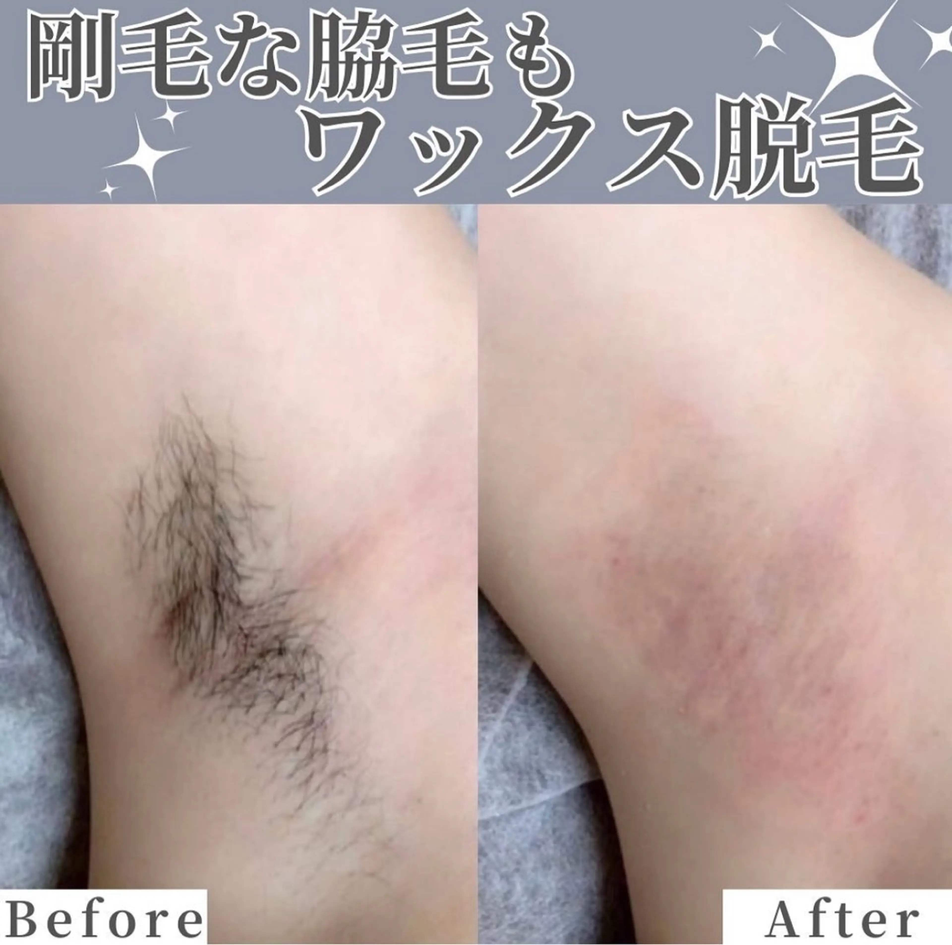 脱毛サロンALGO所属・美肌脱毛/ワックス ALGO高槻店のエステ・リラクイメージ