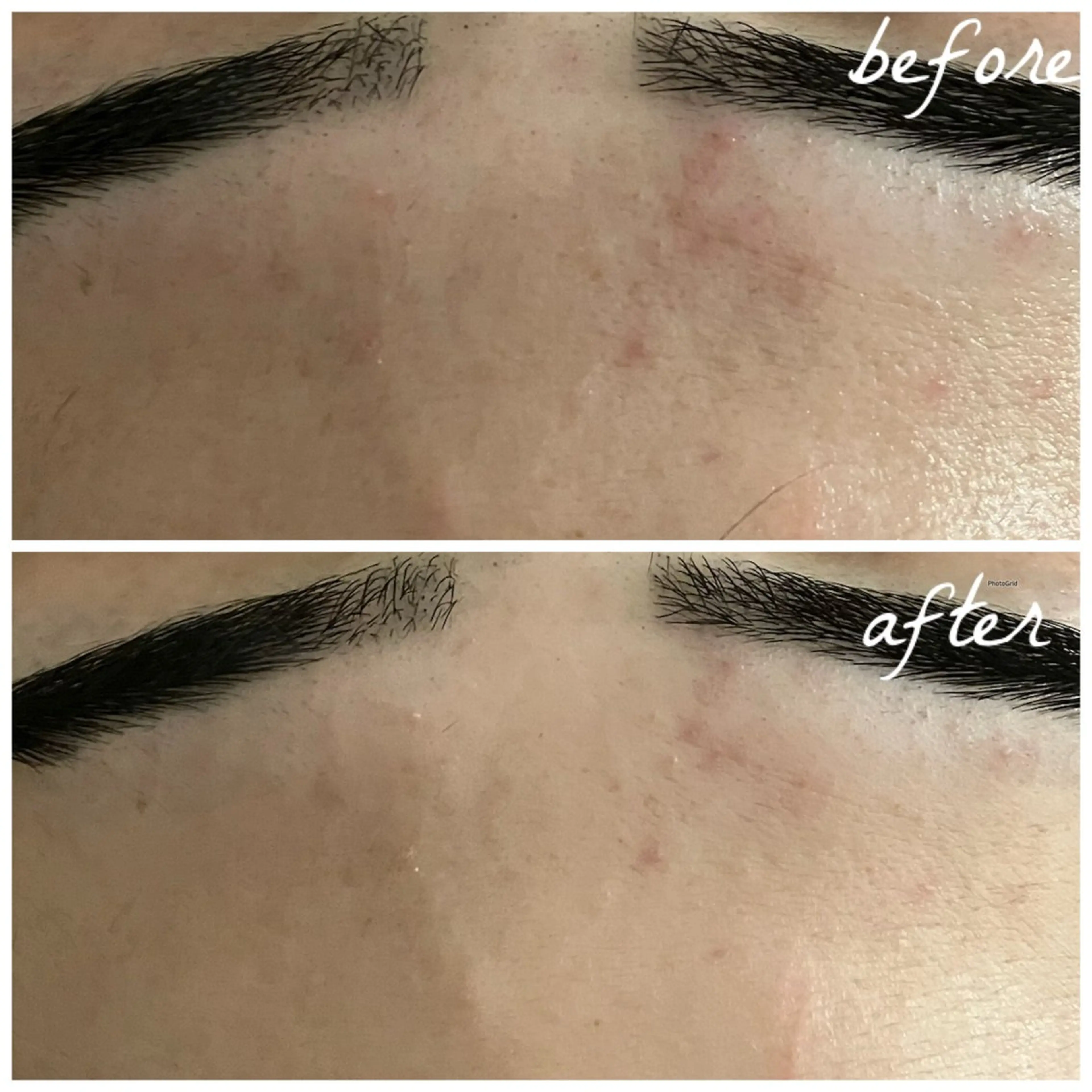 メンズ エステ メナード岐阜茜部 杉浦のエステ・リラクイメージ