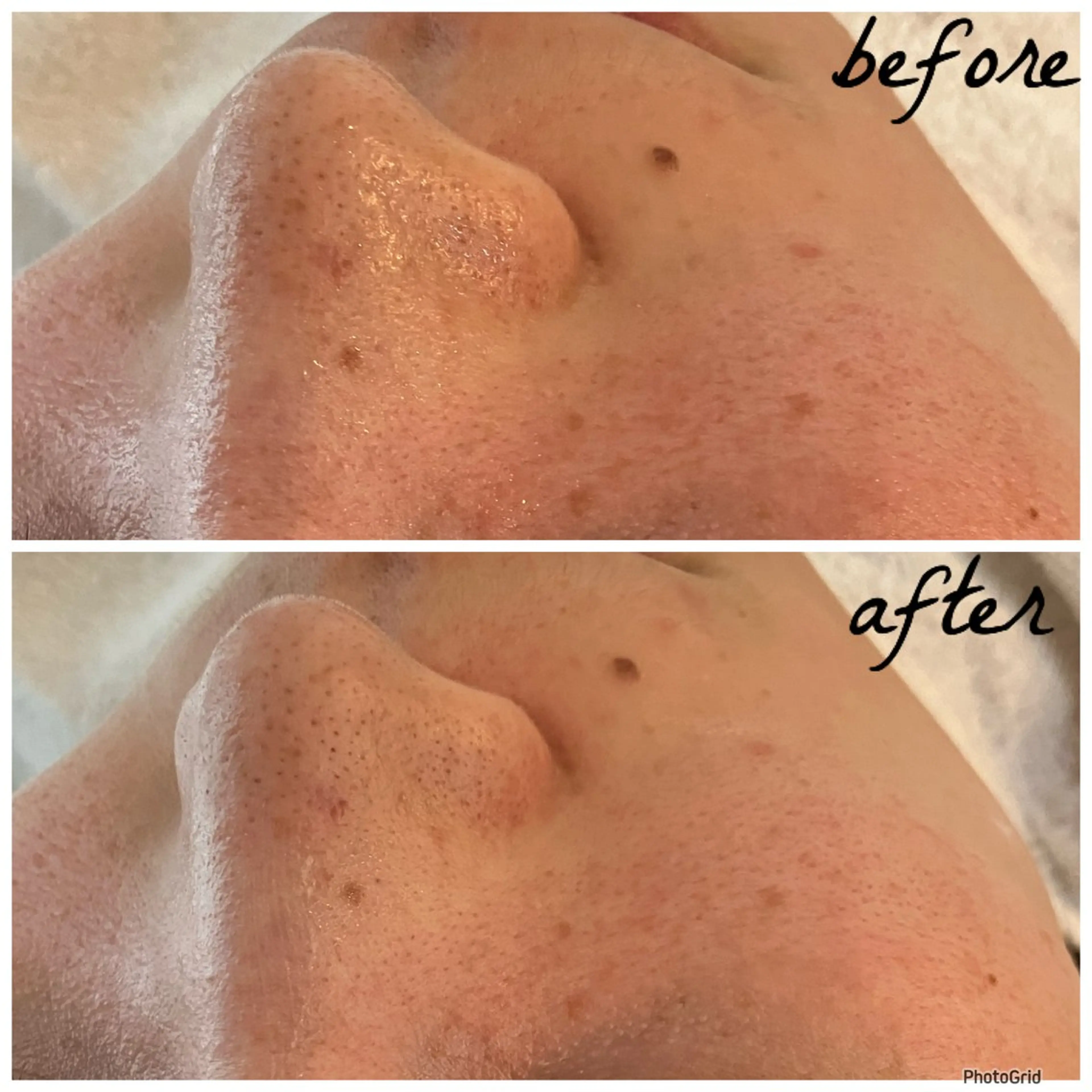 メンズ エステ メナード岐阜茜部 杉浦のエステ・リラクイメージ