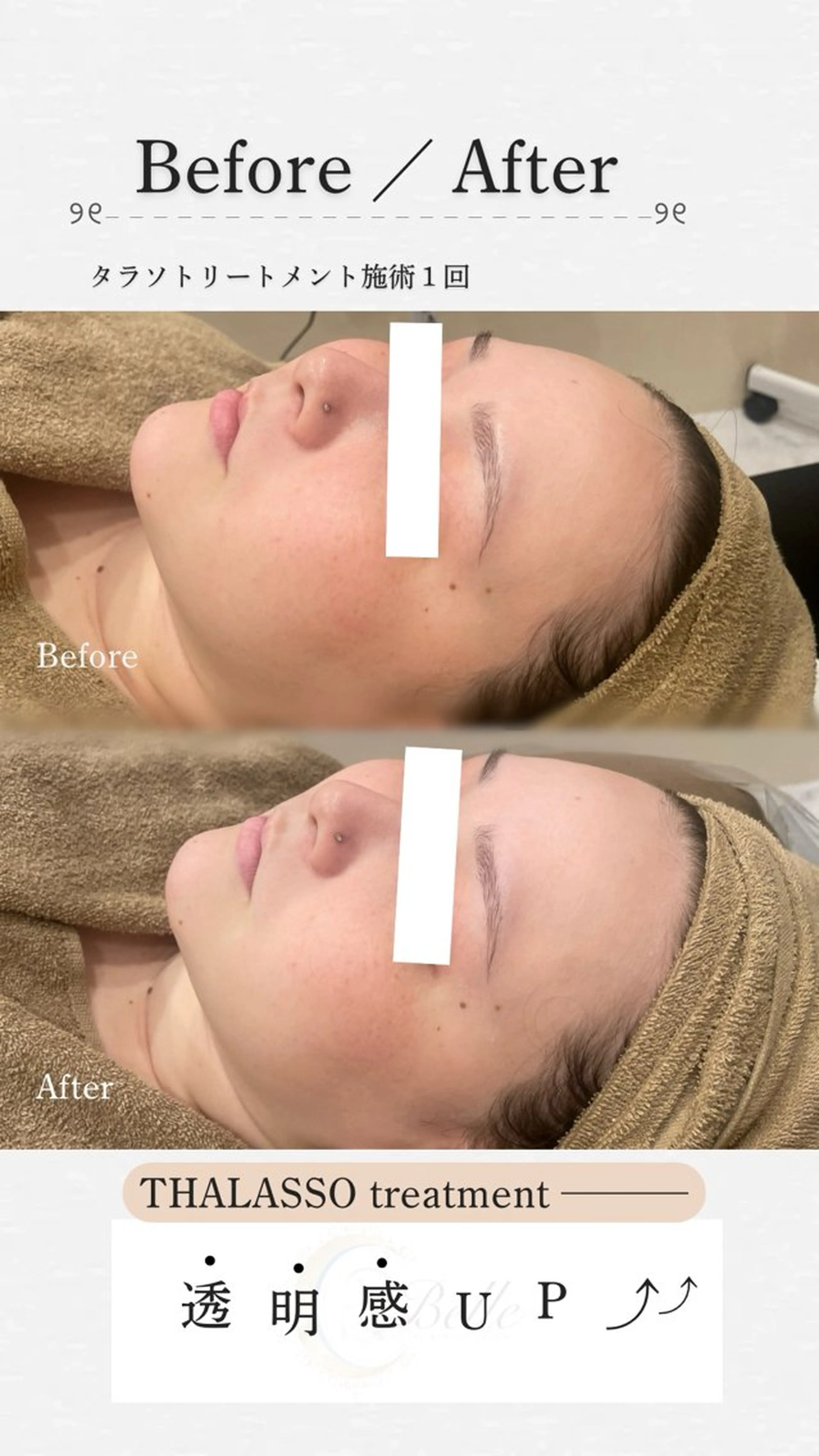 エステ Re:Belle所属・Re:Belle 久留米 : 中島のエステ・リラクイメージ