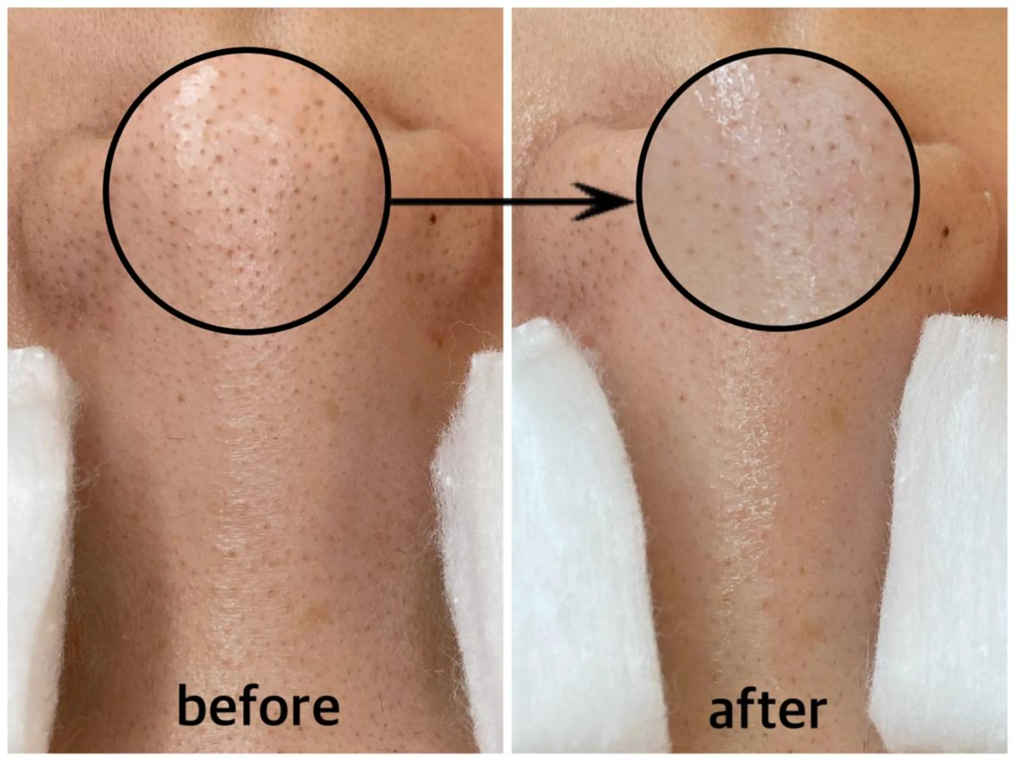 韓国肌管理 【毛穴専科】のエステ・リラクイメージ