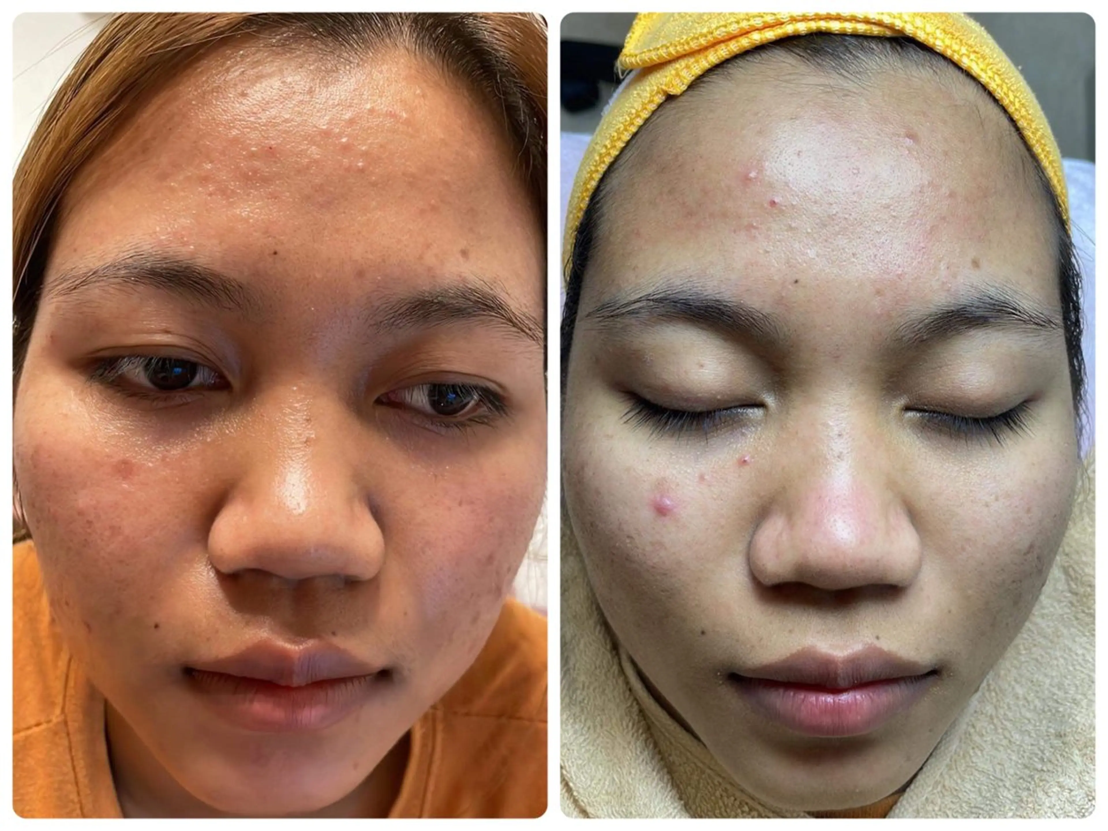 ニキビ、痩身、脱毛、 サクラチャンスパのエステ・リラクイメージ