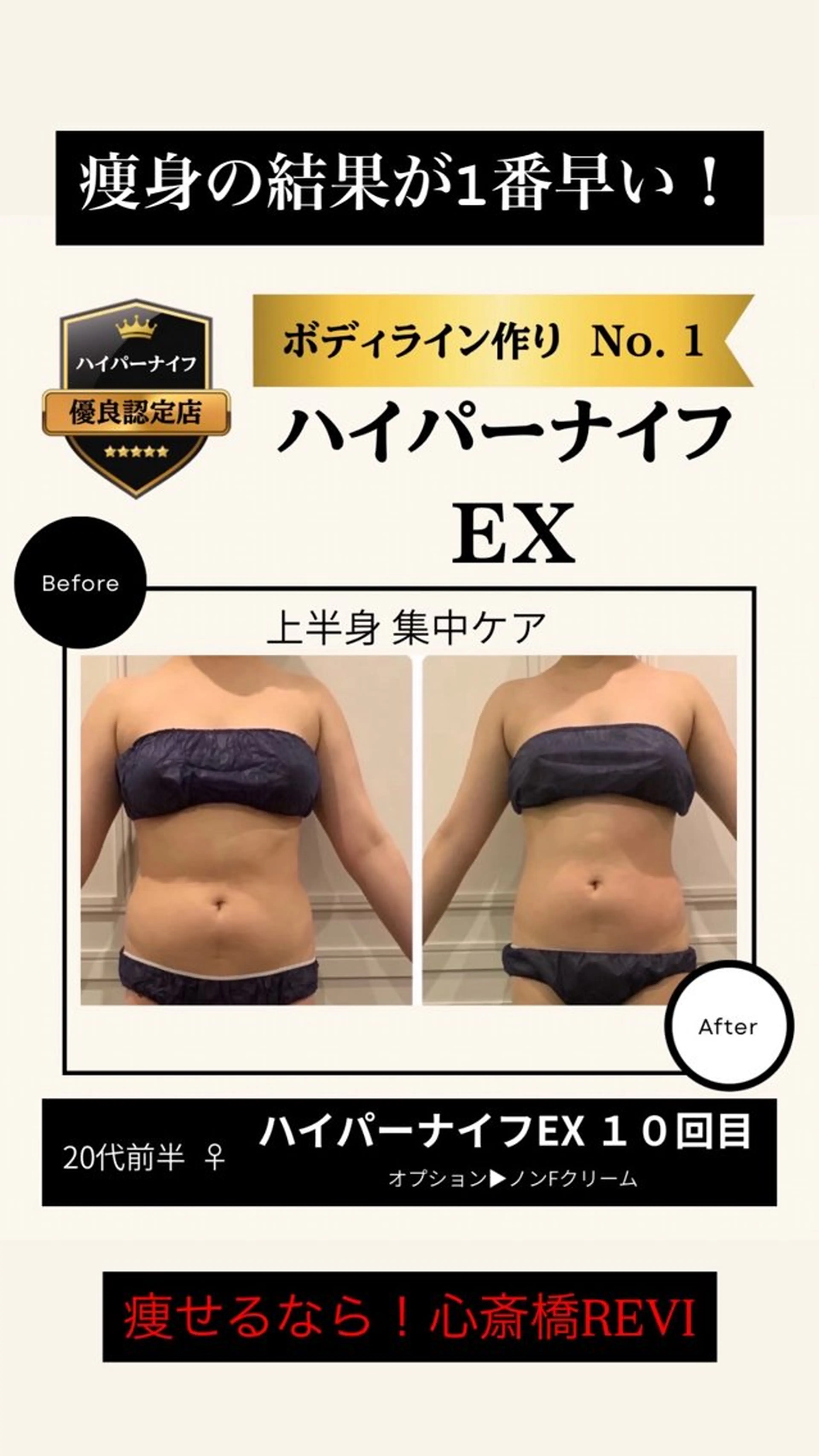 エステ リラク 痩身/美肌小顔専門 夏まで痩身メイン👙のエステ・リラクイメージ