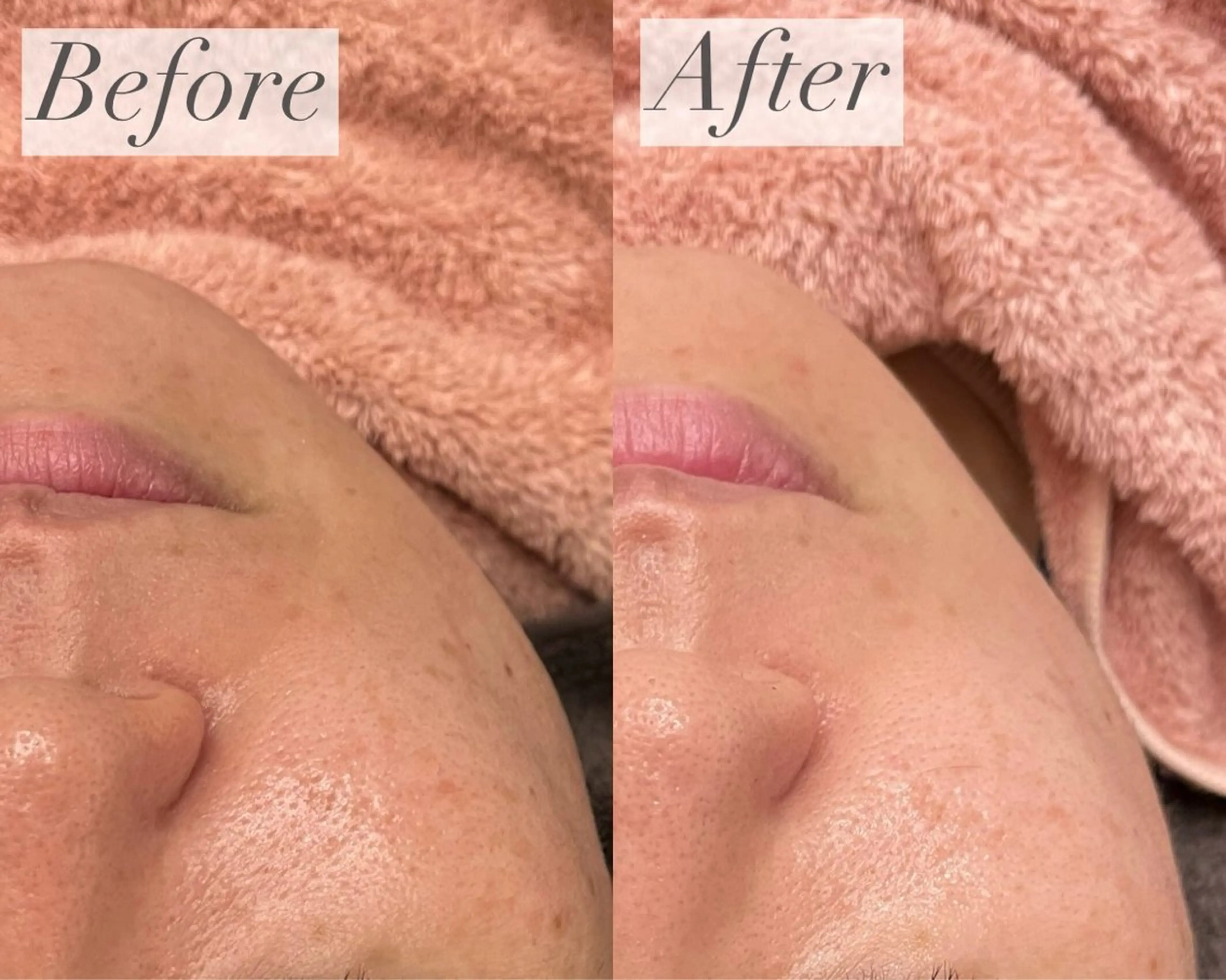 emiluca西目/ 毛穴洗浄/細胞美容のエステ・リラクイメージ