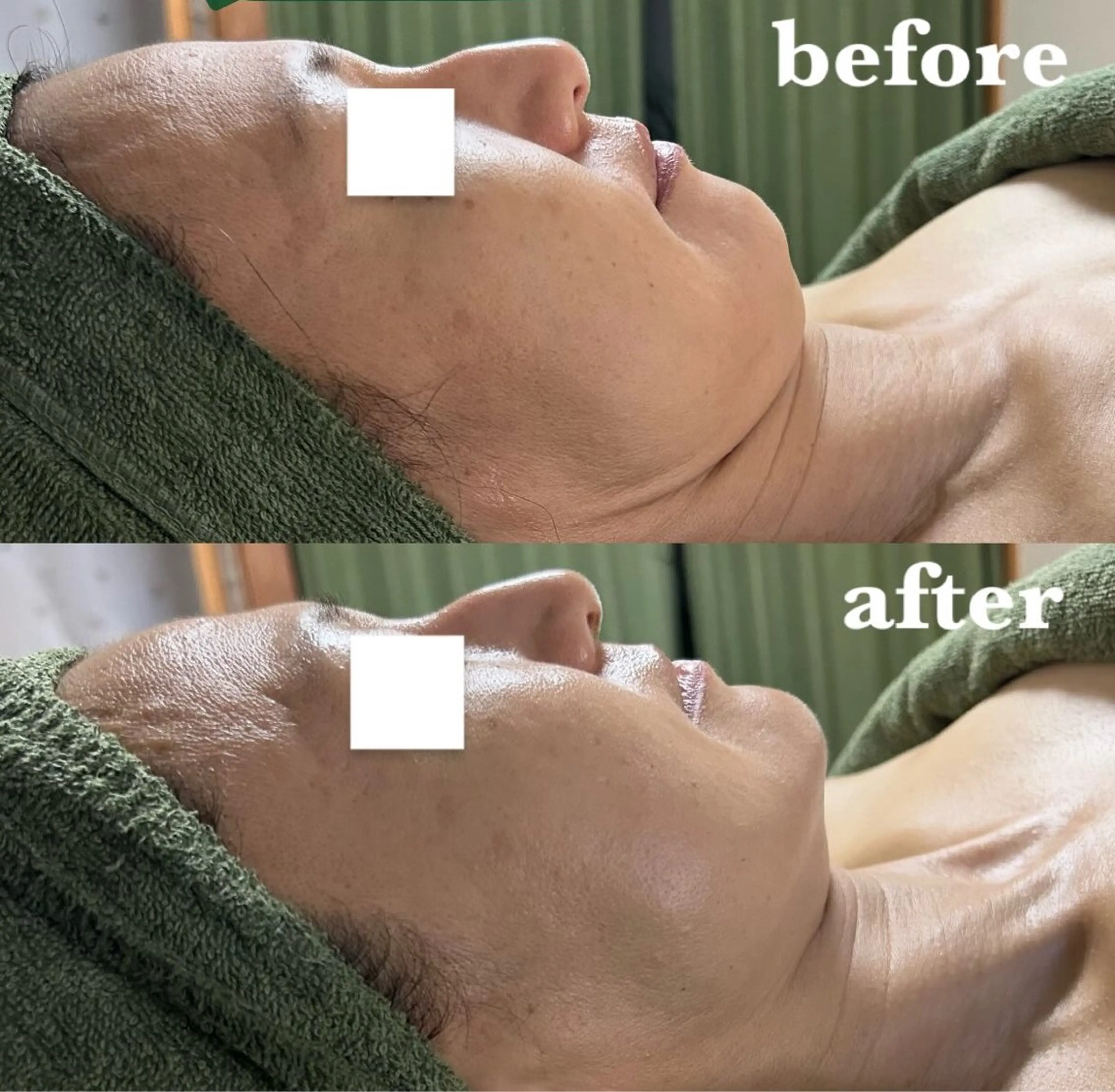 メンズ エステ リラク 【肌質改善サロン】 リーフィアのエステ・リラクイメージ