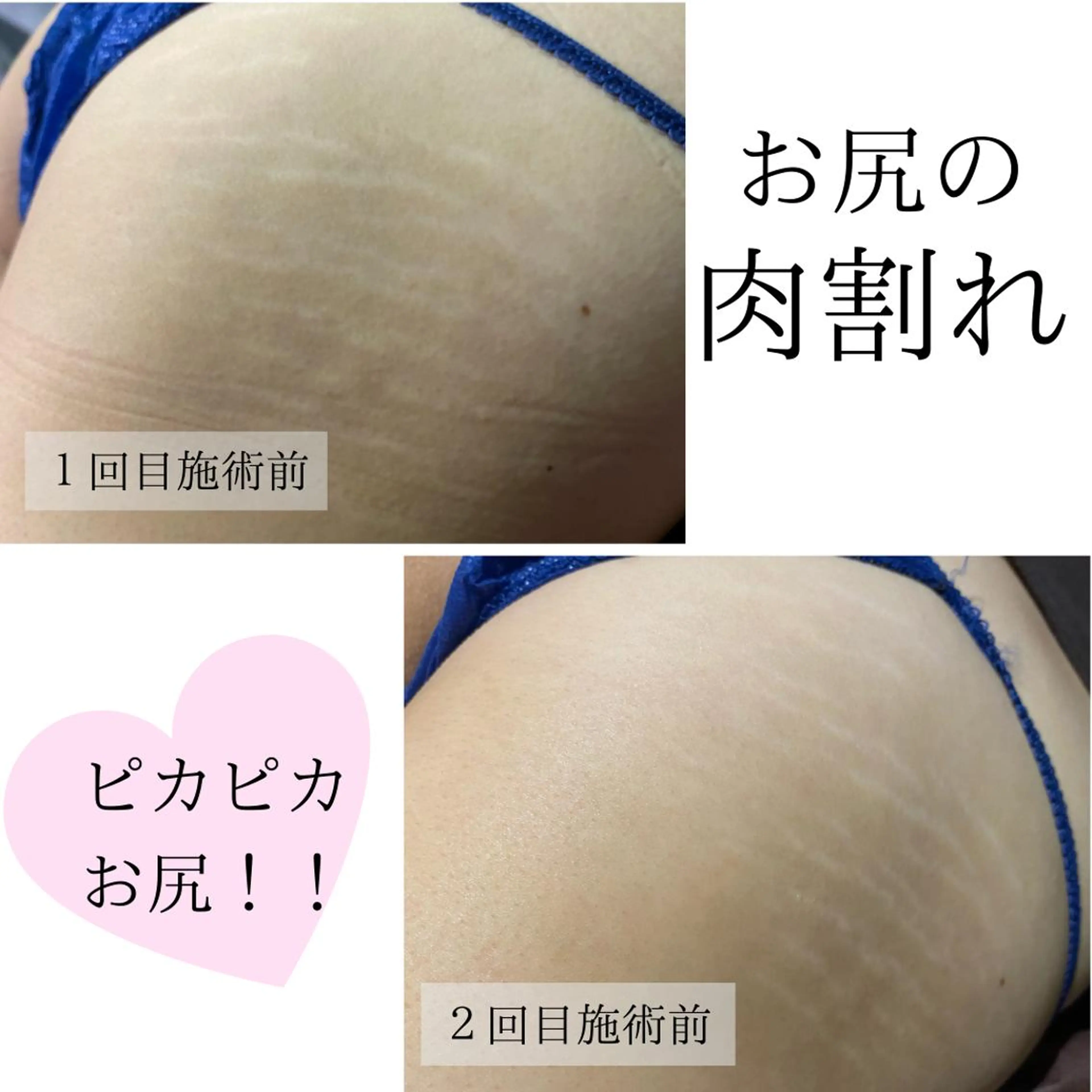 ハーブピーリング・毛穴ケア専門サロンSalon de LENA所属・ハーブピーリング 専門店/名古屋駅前店のエステ・リラクイメージ