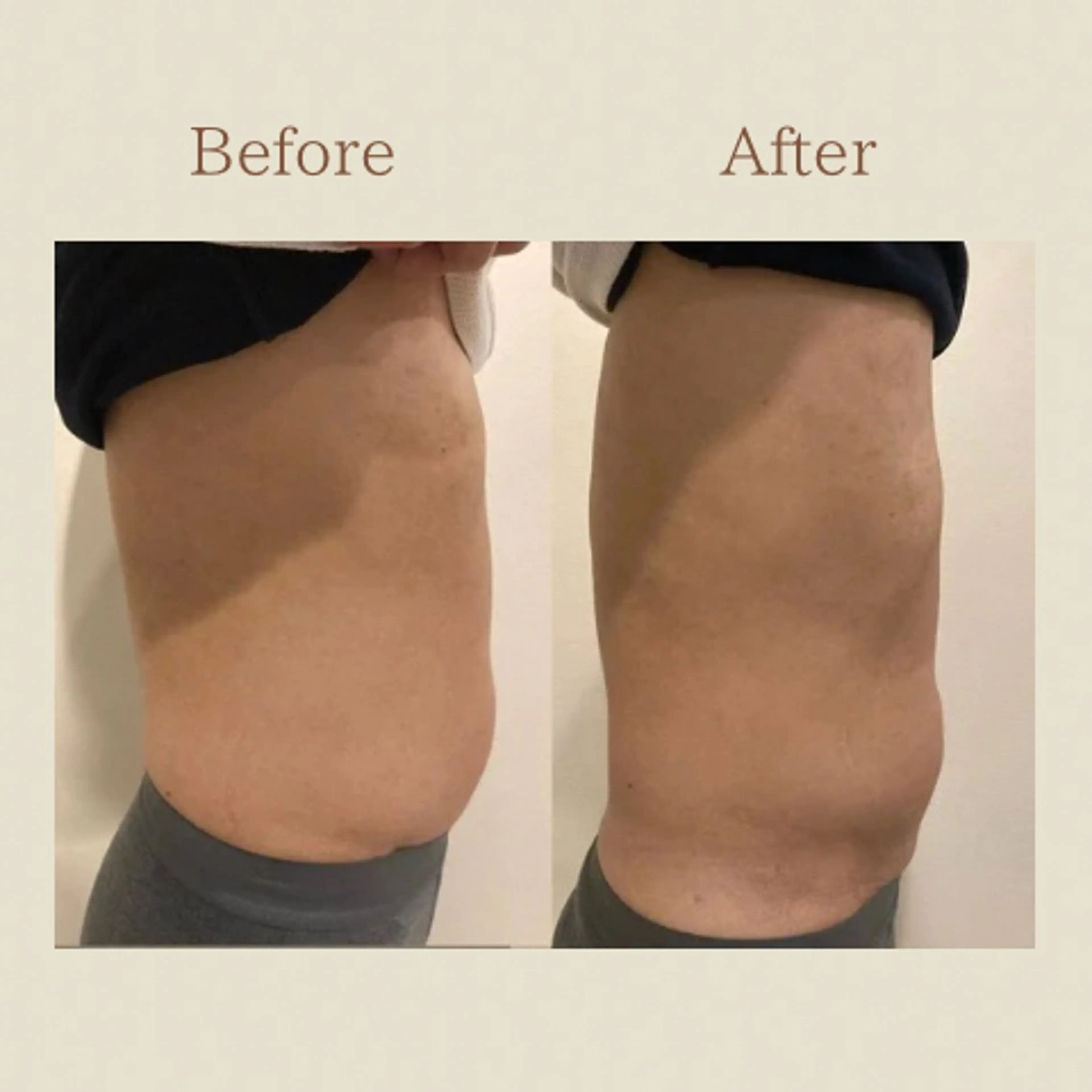 お腹痩せエステ Flat BELLY 恵比寿所属・【腸もみ/脂肪冷却】 お腹エステ/恵比寿のエステ・リラクイメージ
