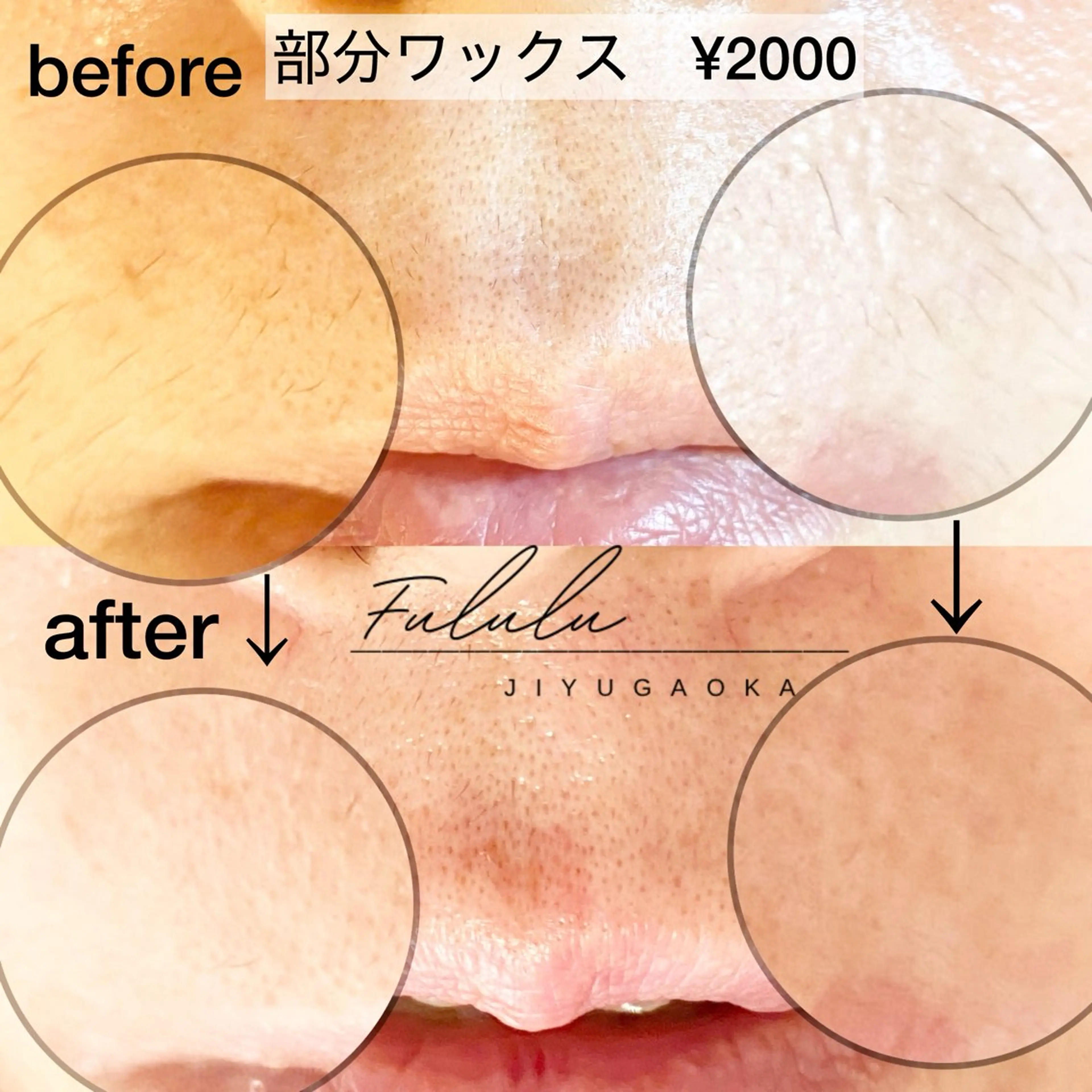 【ミニモ限定】選べる部分ワックス一部位2000円　※鼻毛のみは1500円サクッと綺麗に✨女性限定の写真