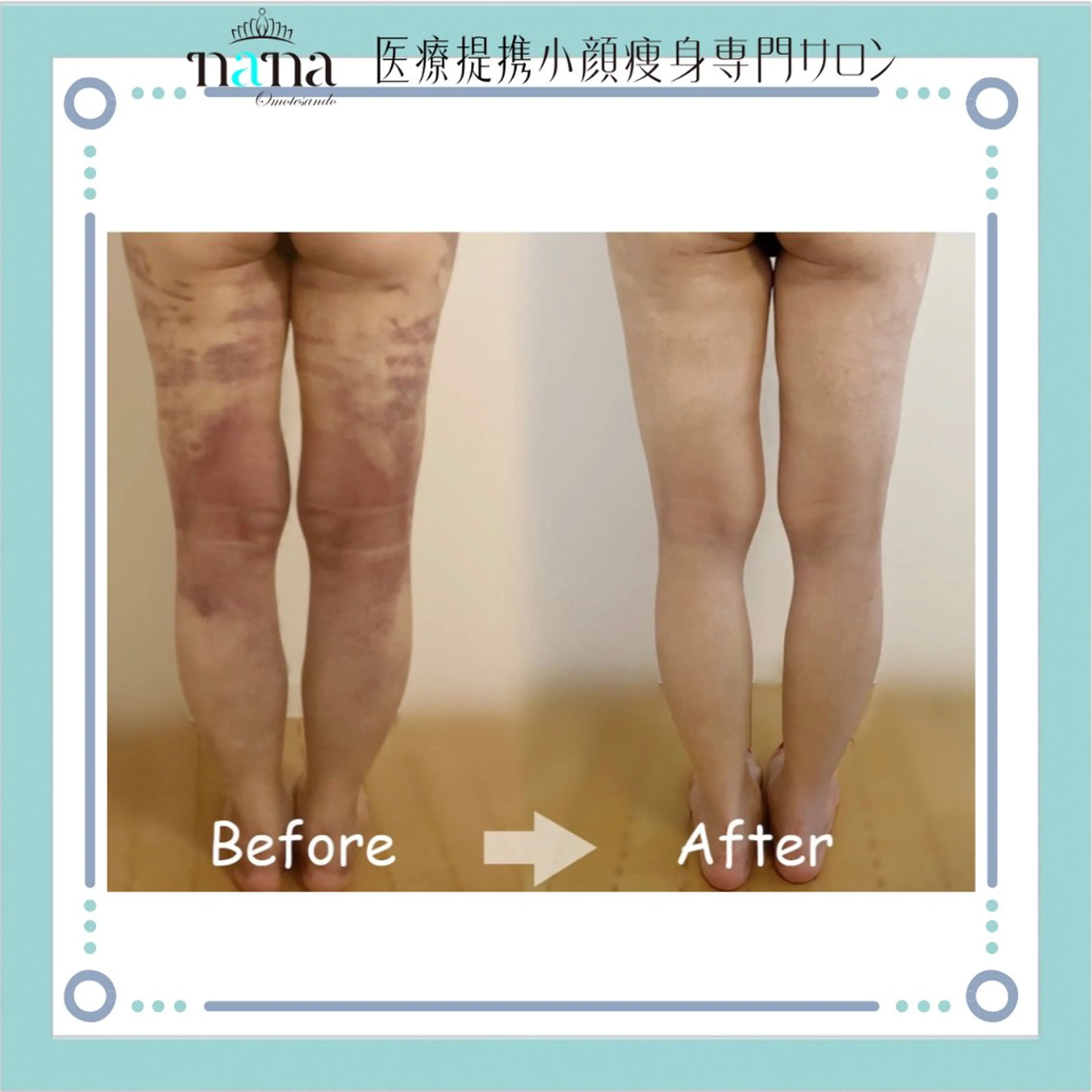 エステ リラク 小顔痩身インディバ Nana表参道のエステ・リラクイメージ