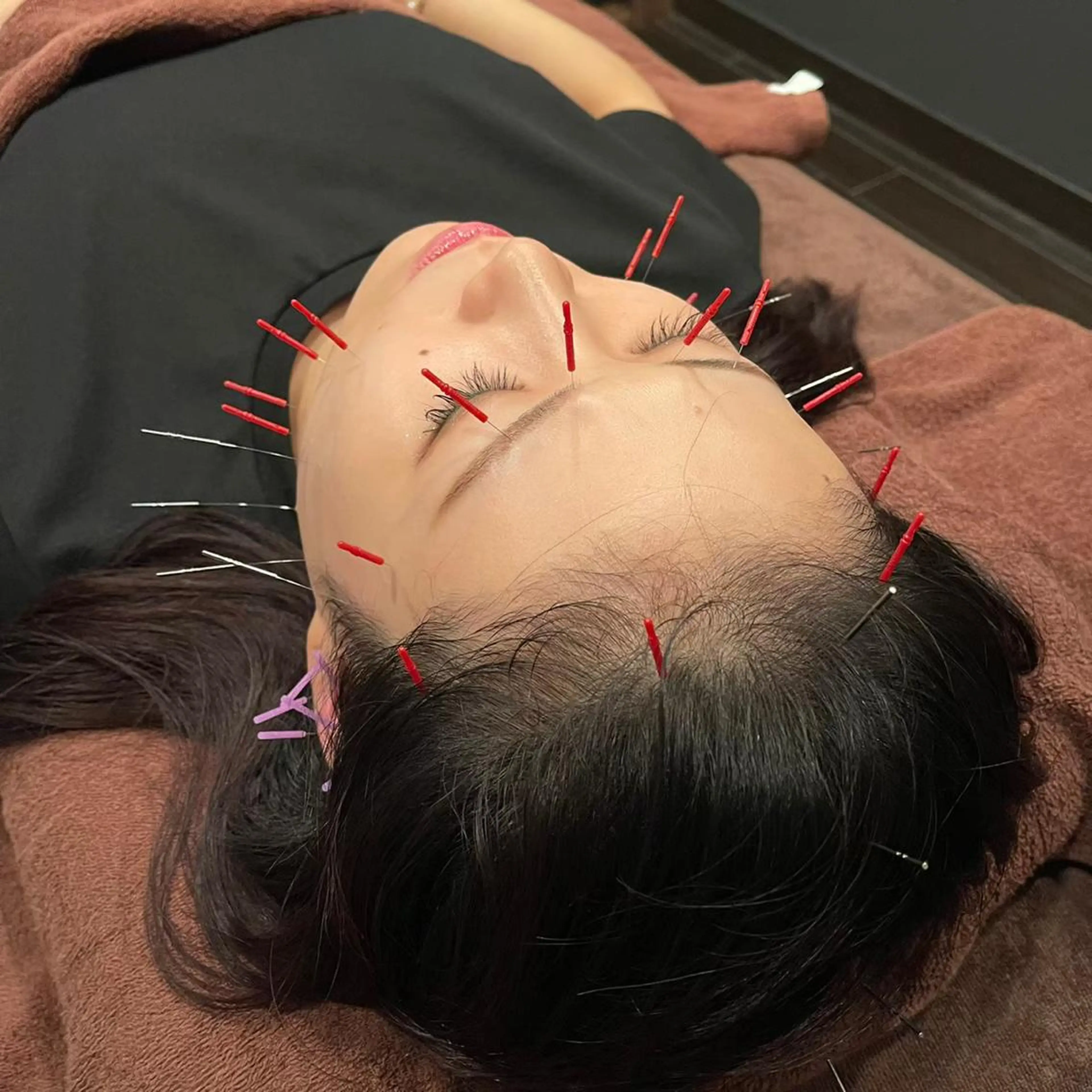 小林整骨院玉川 キジマのエステ・リラクイメージ