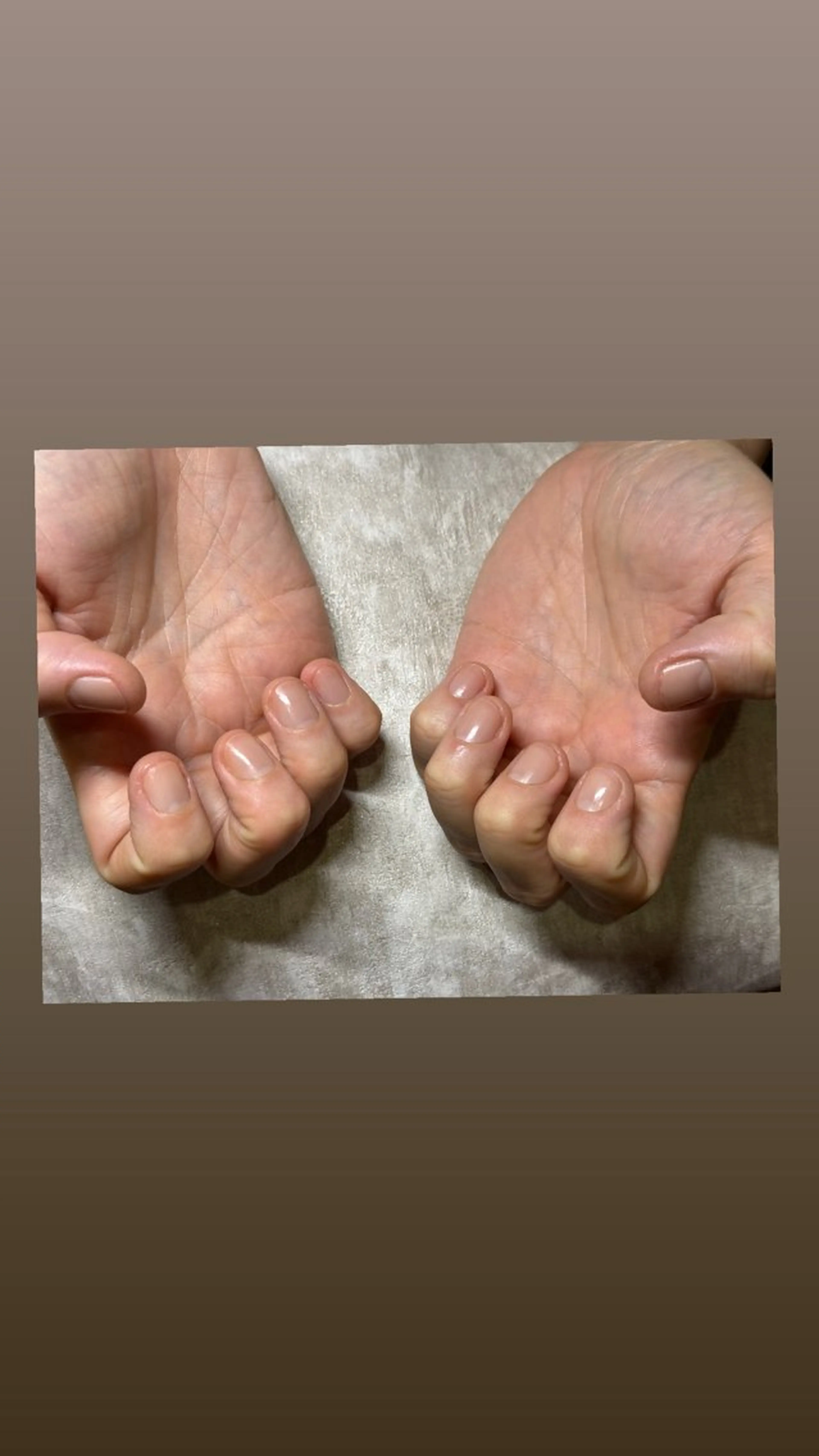 ハンドネイルケアの写真