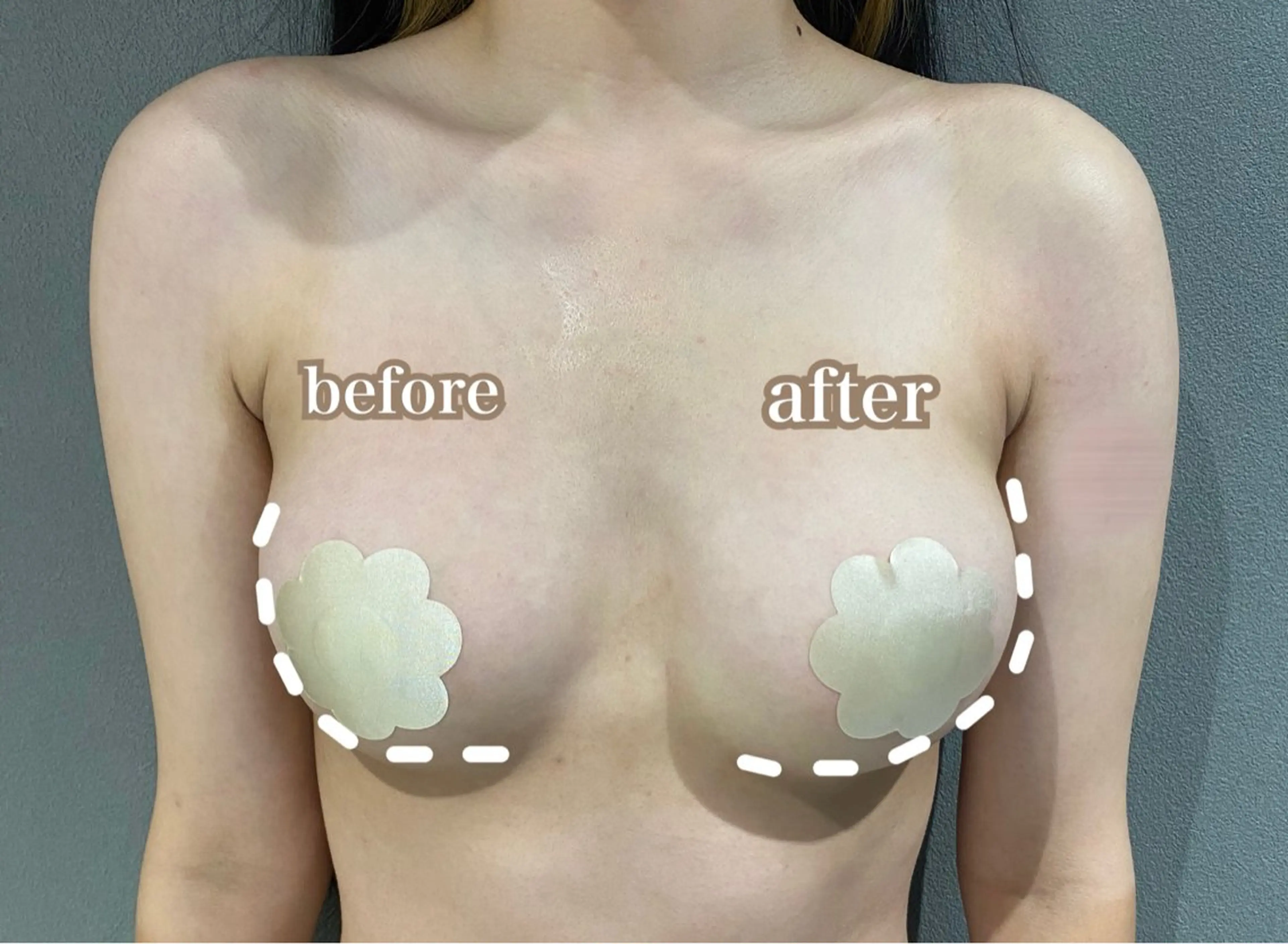 バストアップ＋美容液導入付きの写真