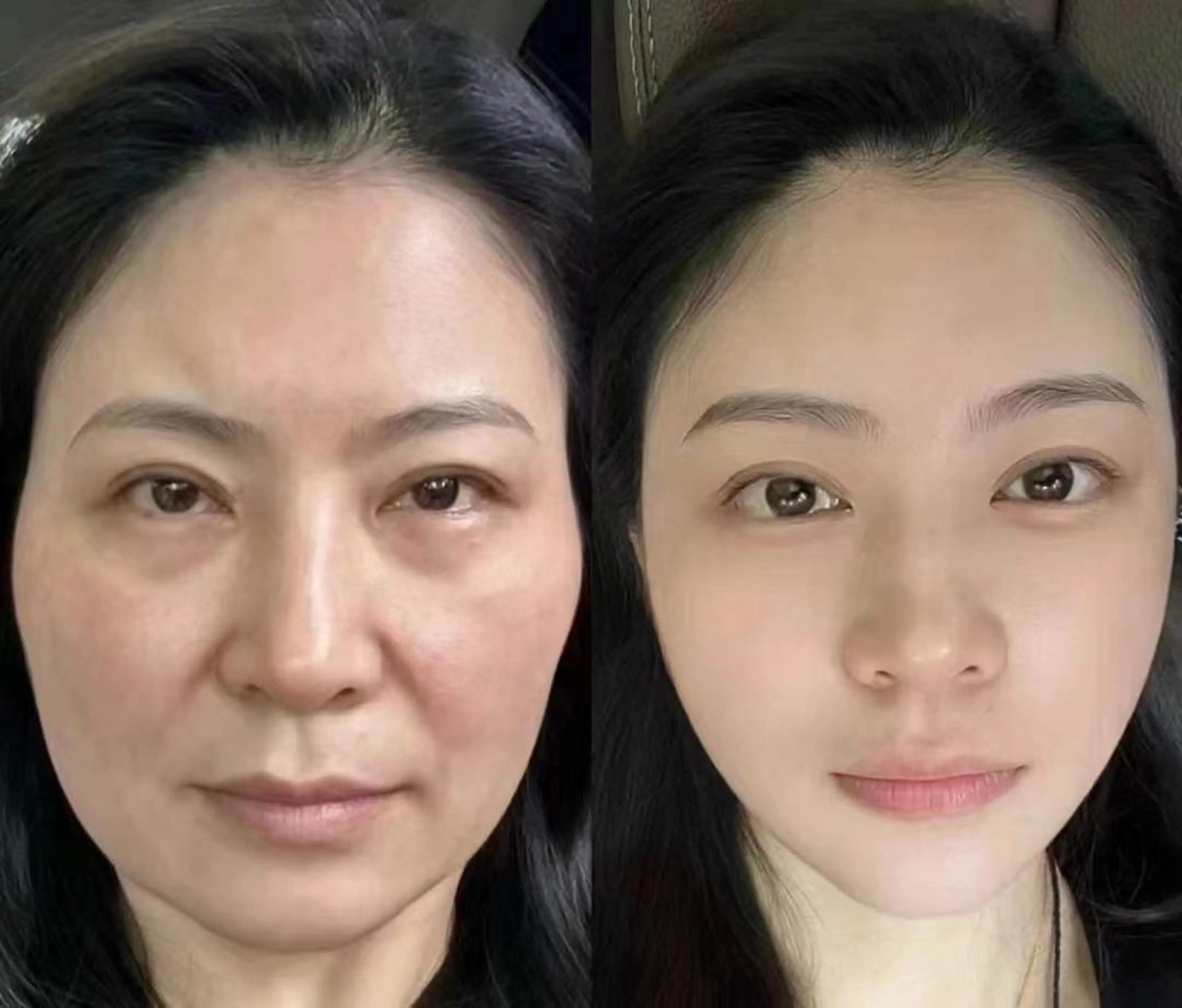 ネイル エステ aliaハイフ&水光ジェットサロン所属・aliaハーブ水光店 エステティシャン募集のエステ・リラクイメージ