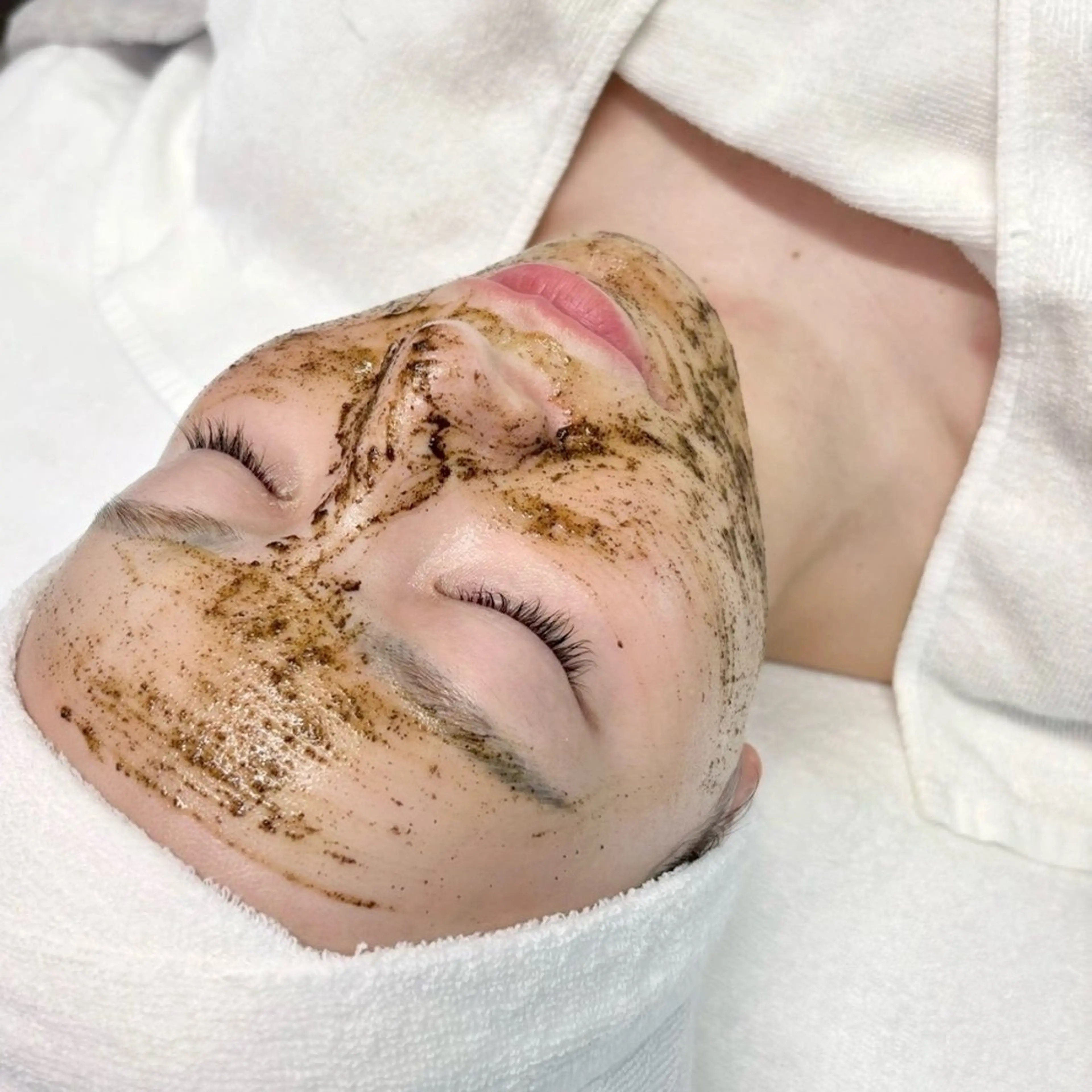 【剥離なしハーブピーリング🌿】1日3枠限定❗️特別価格💚の写真