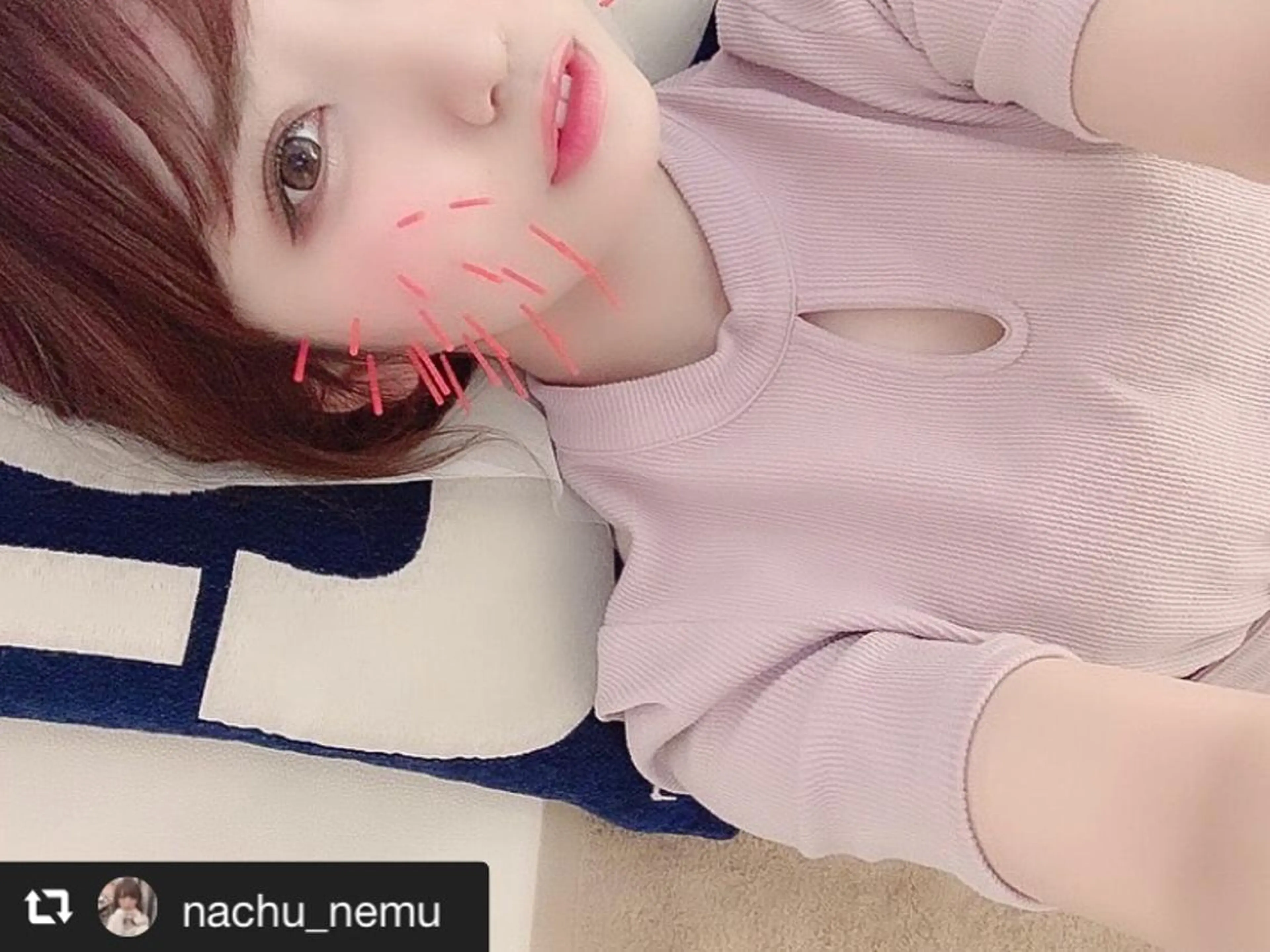 鍼灸整骨院Refine所属・鍼灸 Refineのその他イメージ