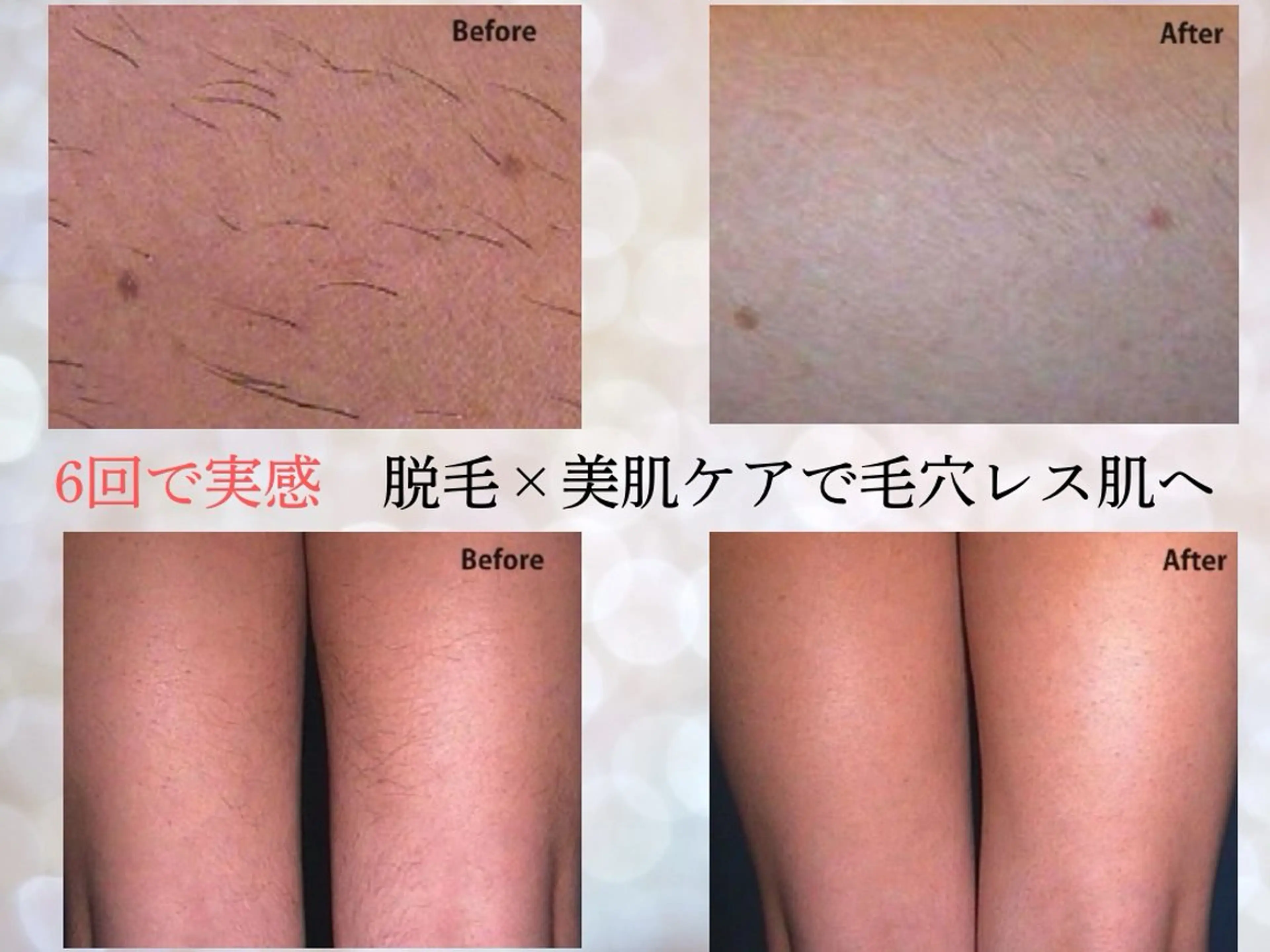 VIKI BEAUTY  クレイハーブピーリング・美肌脱毛専門店所属・VIKI BEAUTYのエステ・リラクイメージ