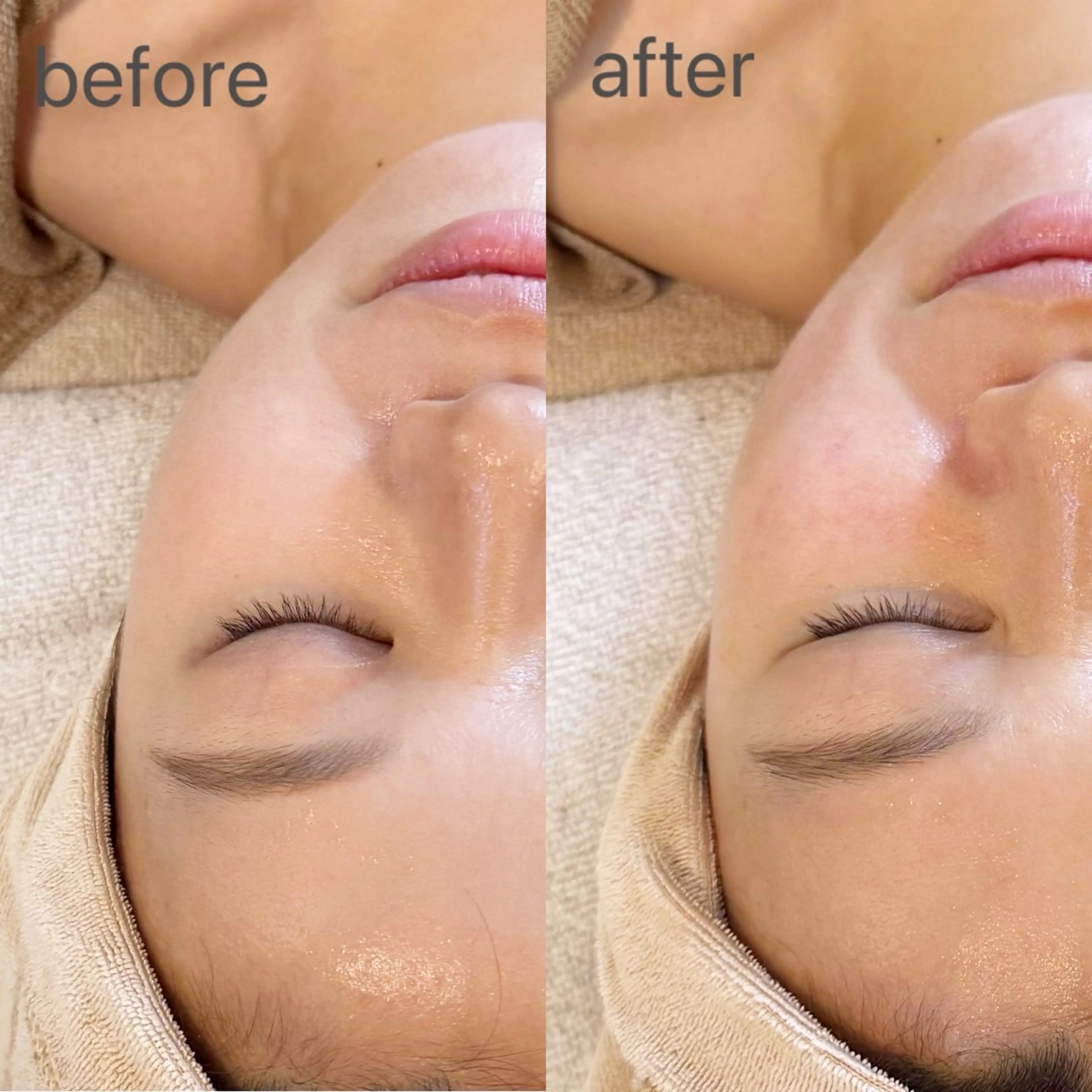 エステ MiEL total beauty salon所属・Rie ×MiELのエステ・リラクイメージ