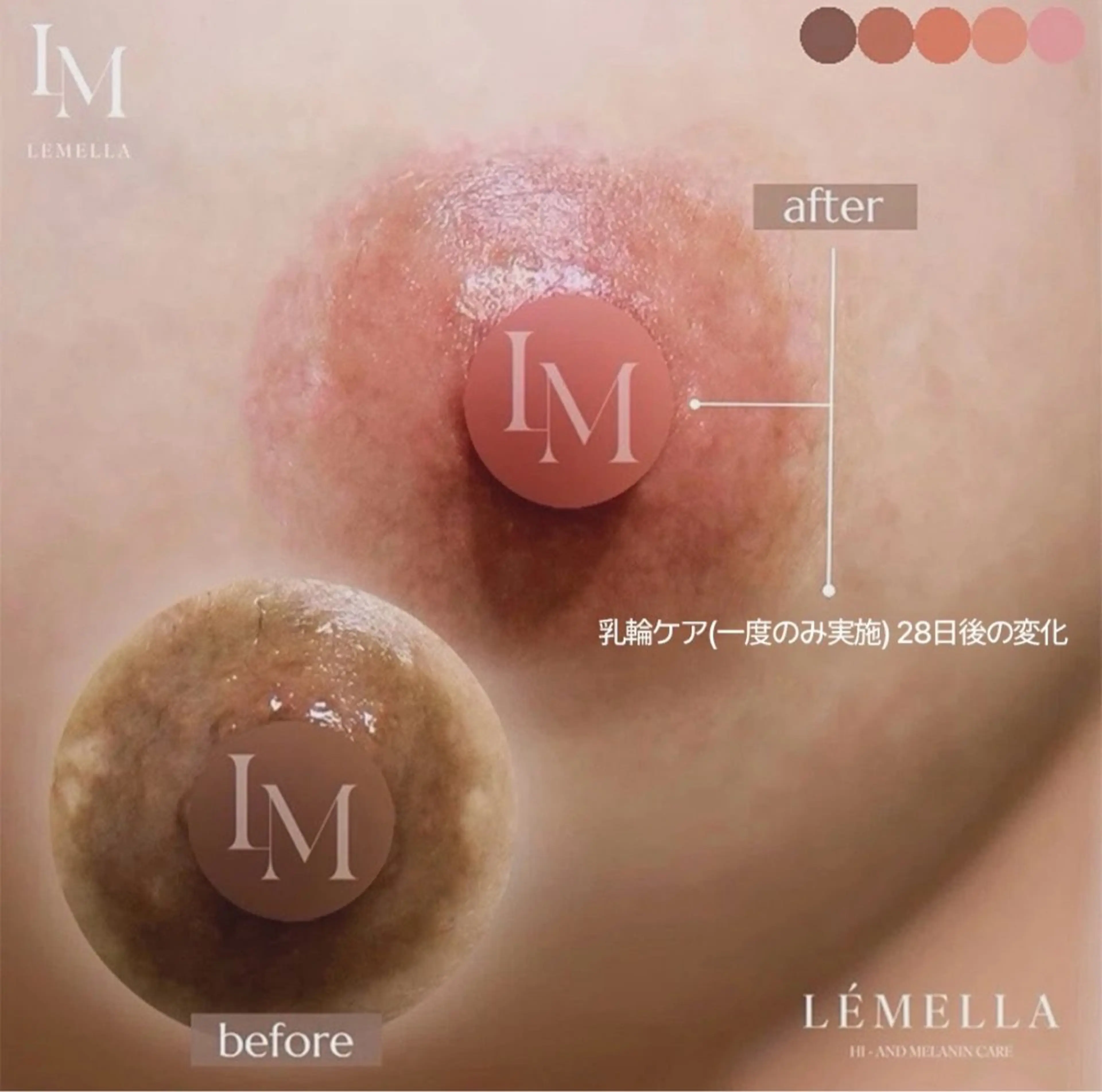 📍バストトップ  🌟1番人気！トーンアップで自信を持てるバストへ🌟ルメラ/メラニンケアの写真