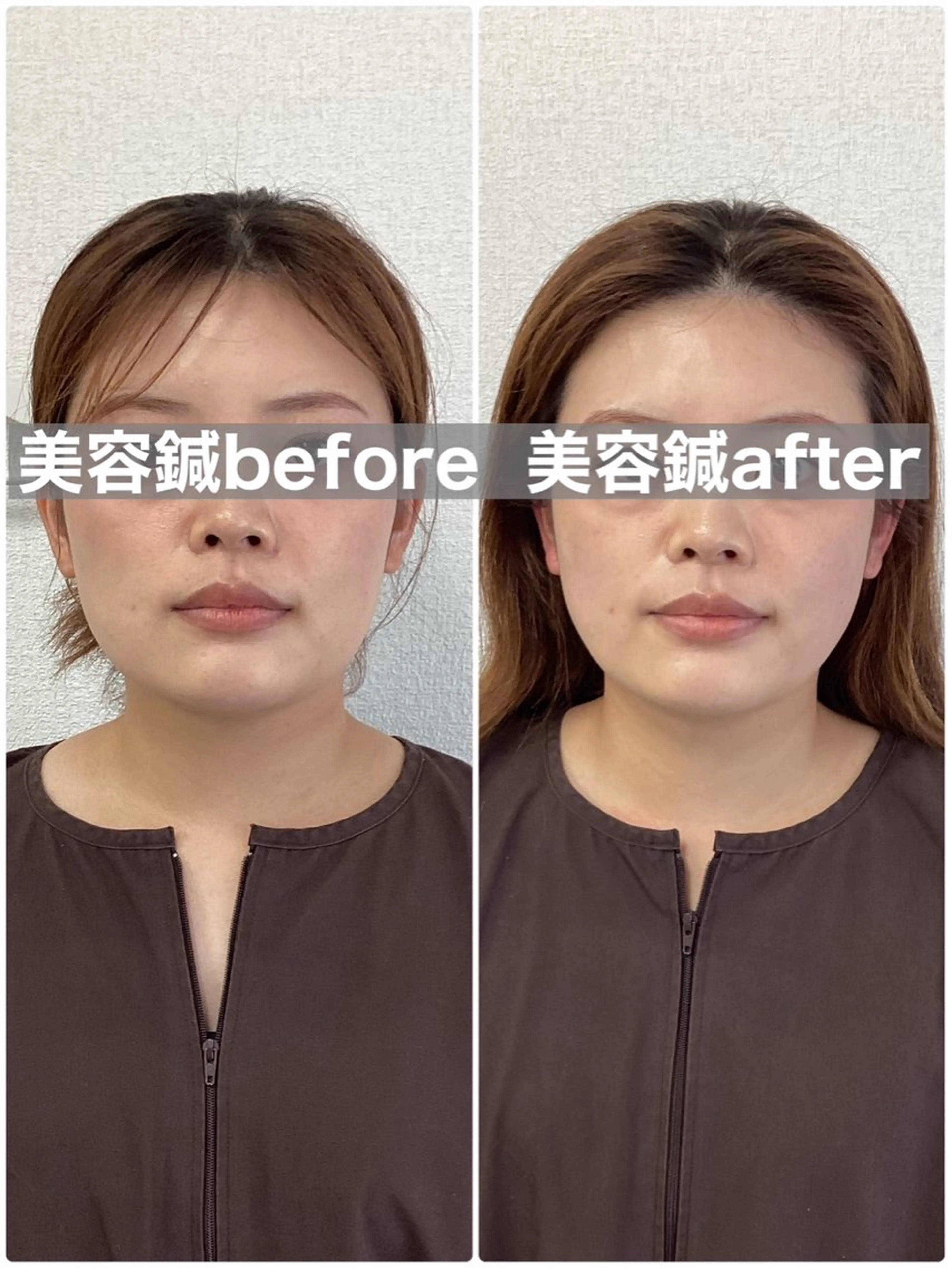hari salon de off　美容鍼灸×小顔整体【ハリサロンドオフ】所属・美容鍼×小顔整体🤍 ishibashiのエステ・リラクイメージ