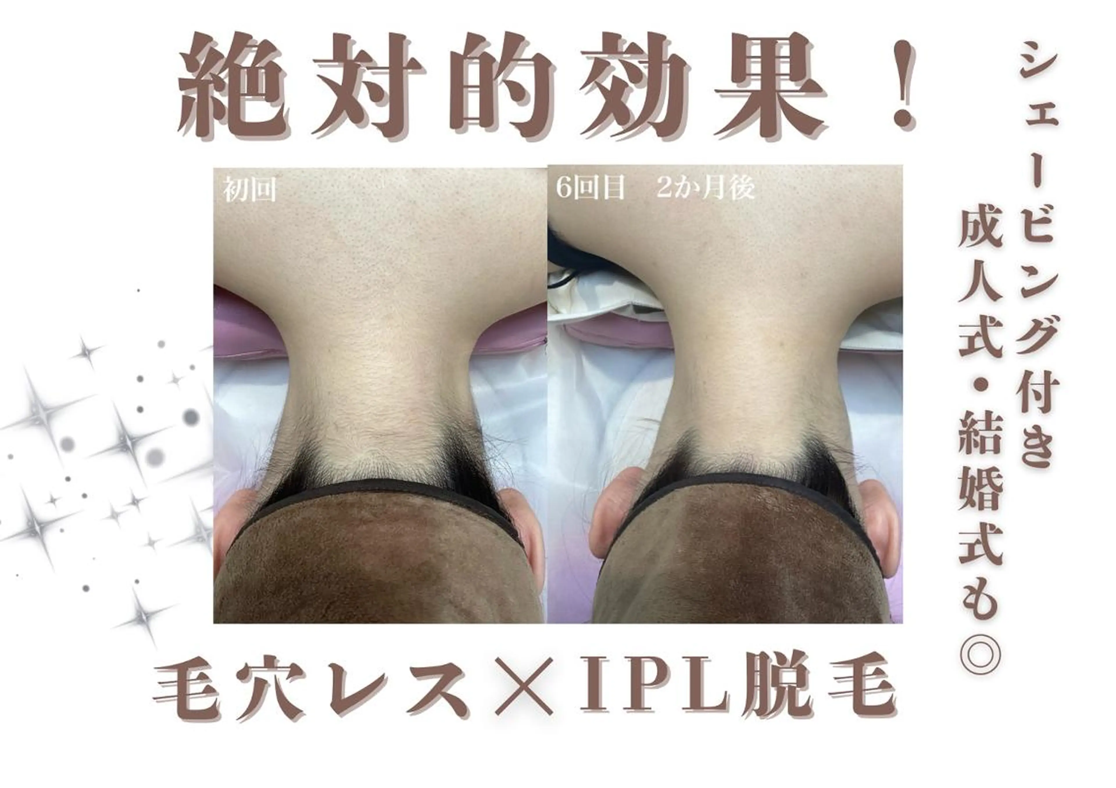 ヘアアレンジ 脱毛 U24💗学割エステ 💗RAYVIS池袋のエステ・リラクイメージ