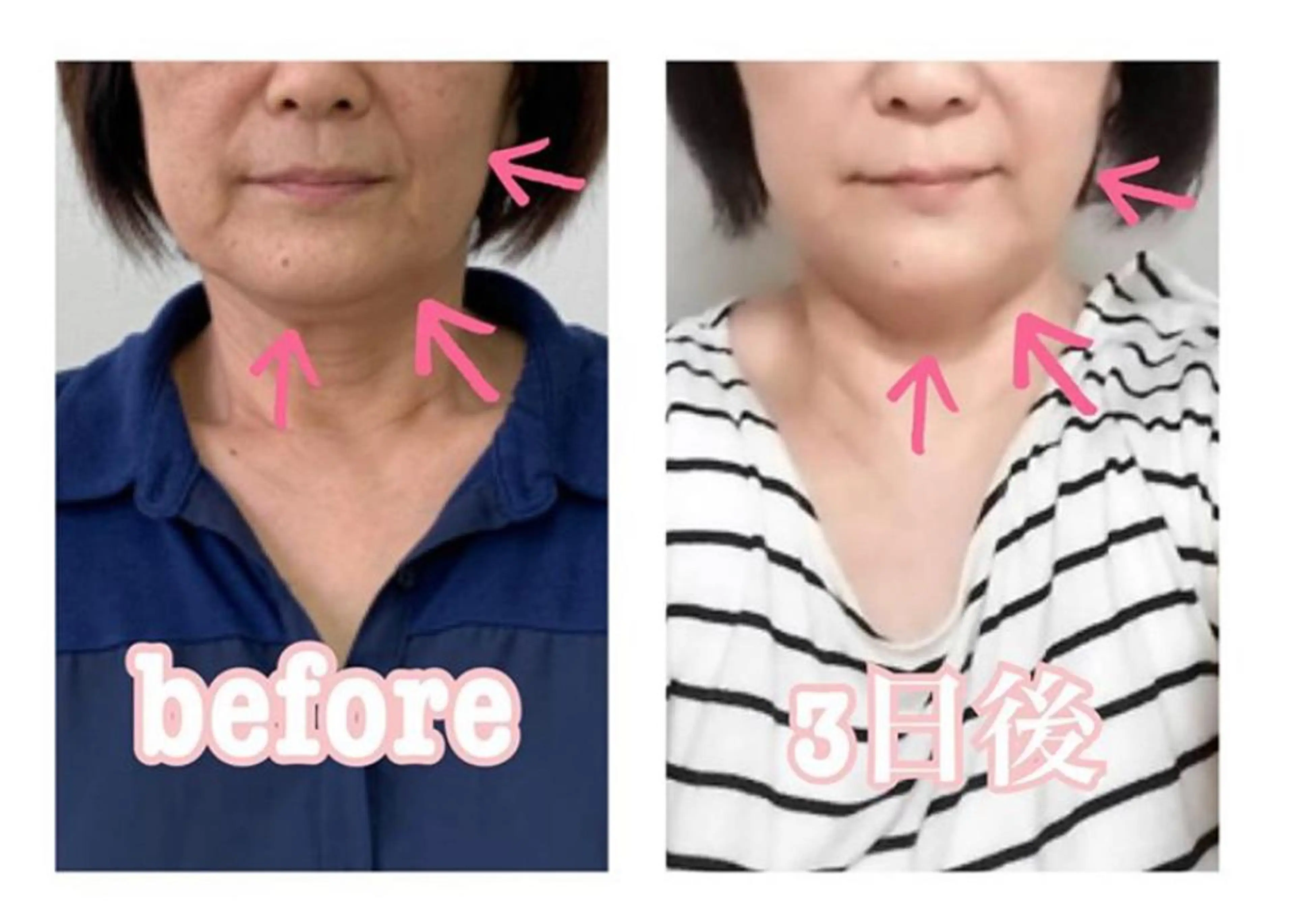 エステ リラク 小顔と ヘッドスパのお店のエステ・リラクイメージ